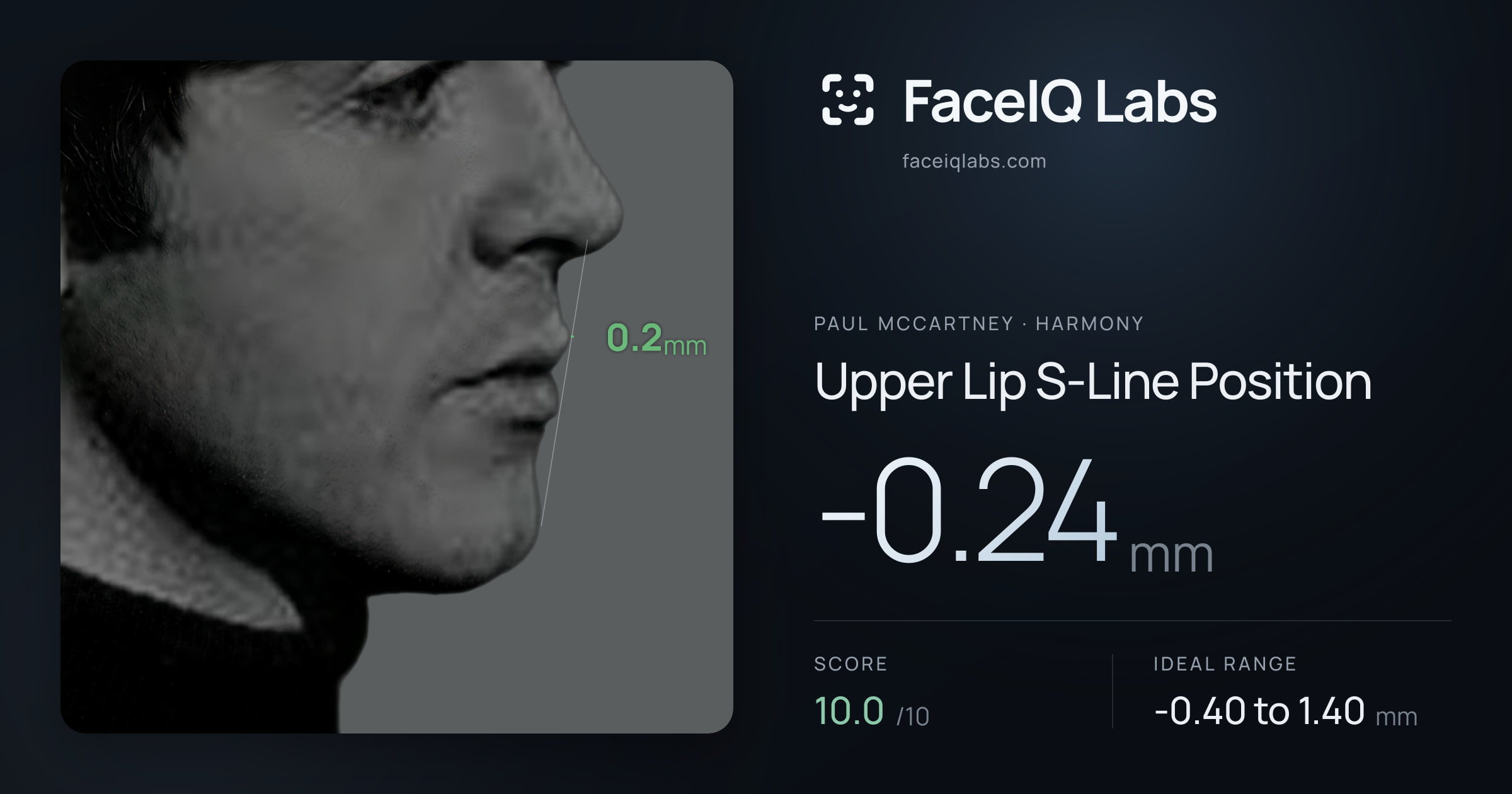 Paul McCartney Upper Lip S-Line Position: -0.24mm, drawn on the photo