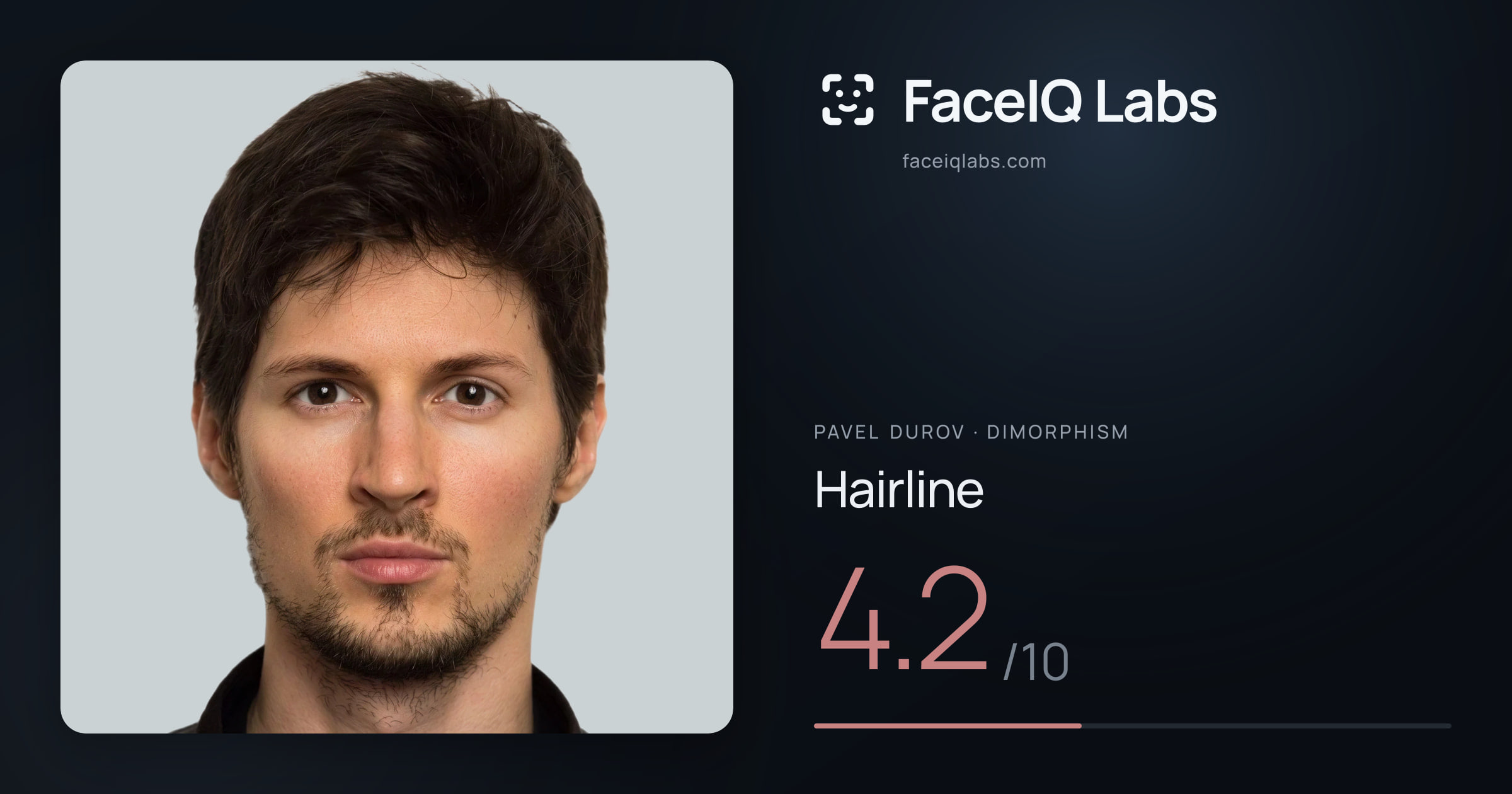 Pavel Durov Hairline: 4.2/10, drawn on the photo