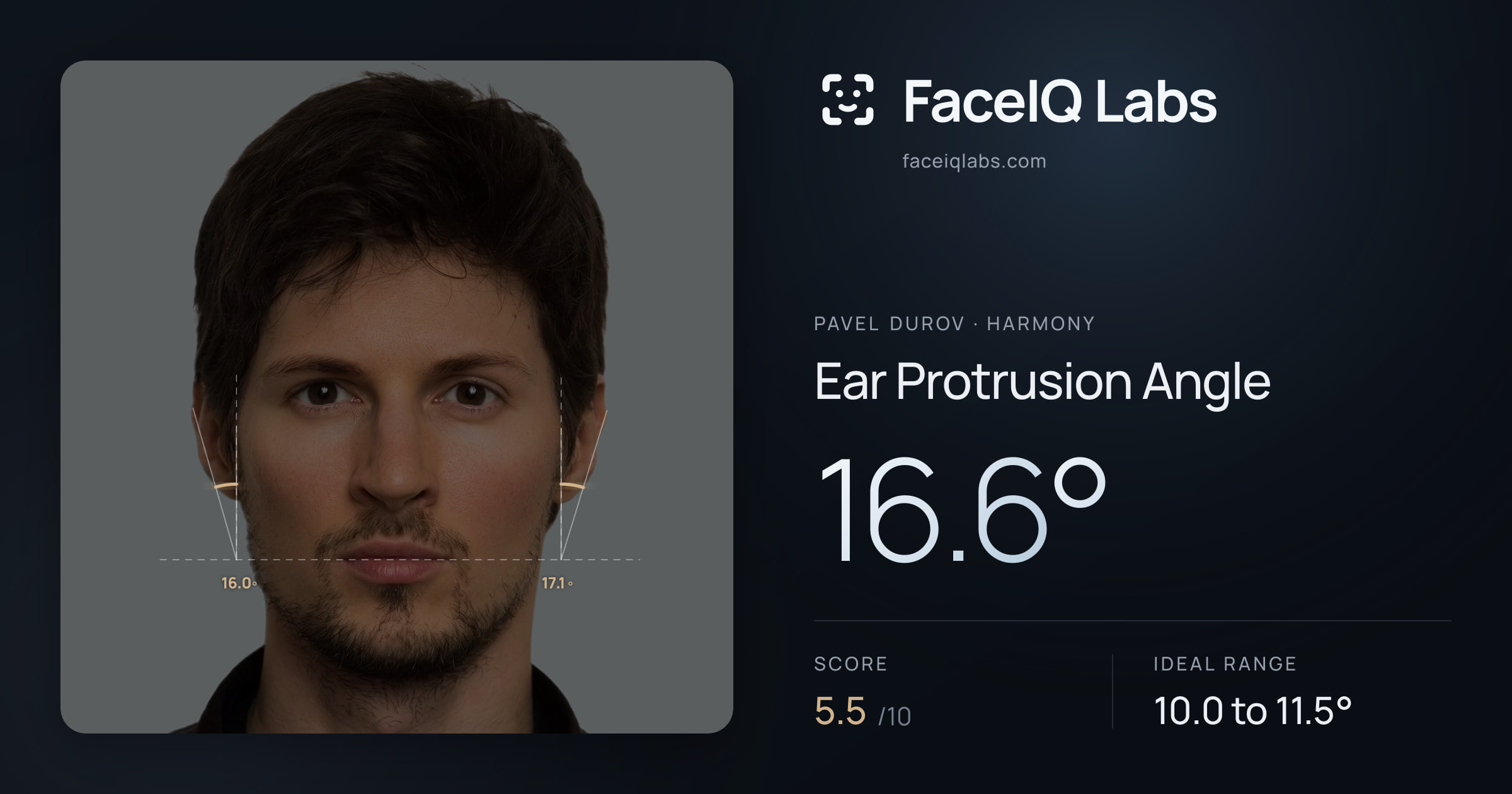 Pavel Durov Ear Protrusion Angle: 16.6°, drawn on the photo