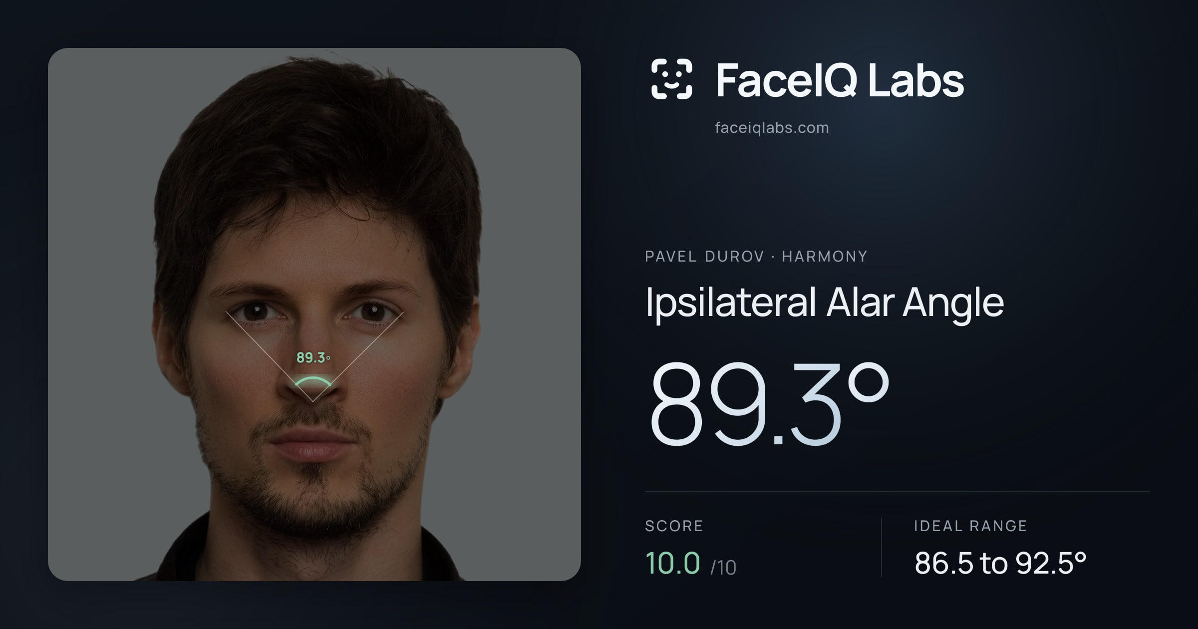 Pavel Durov Ipsilateral Alar Angle: 89.3°, drawn on the photo