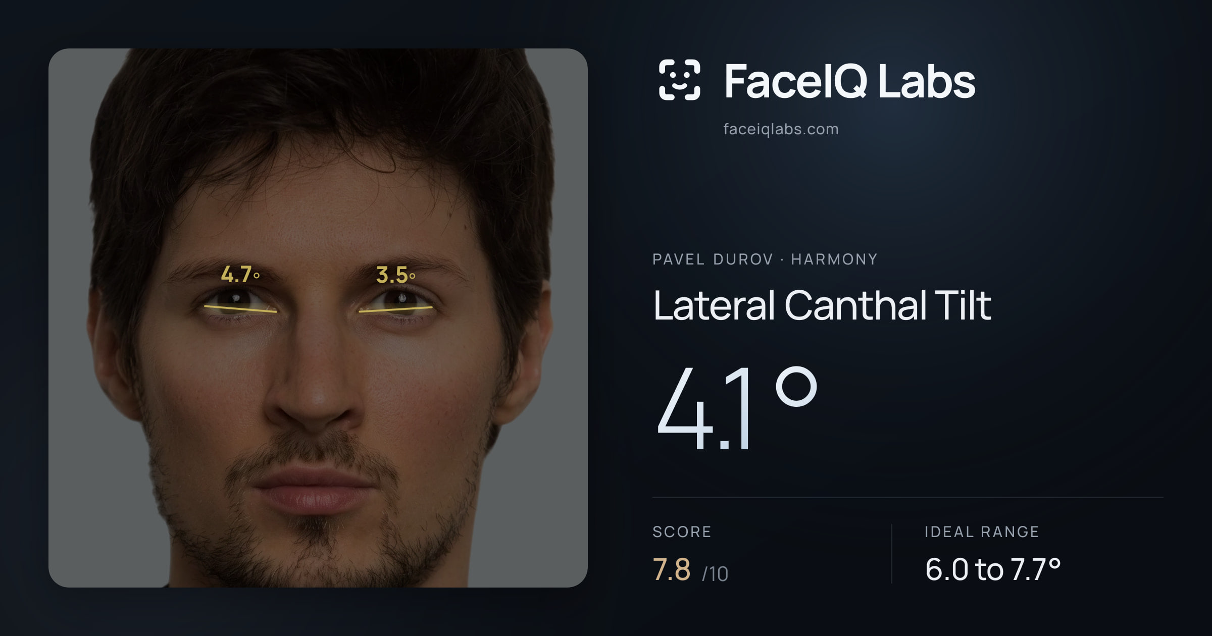 Pavel Durov Lateral Canthal Tilt: 4.1°, drawn on the photo