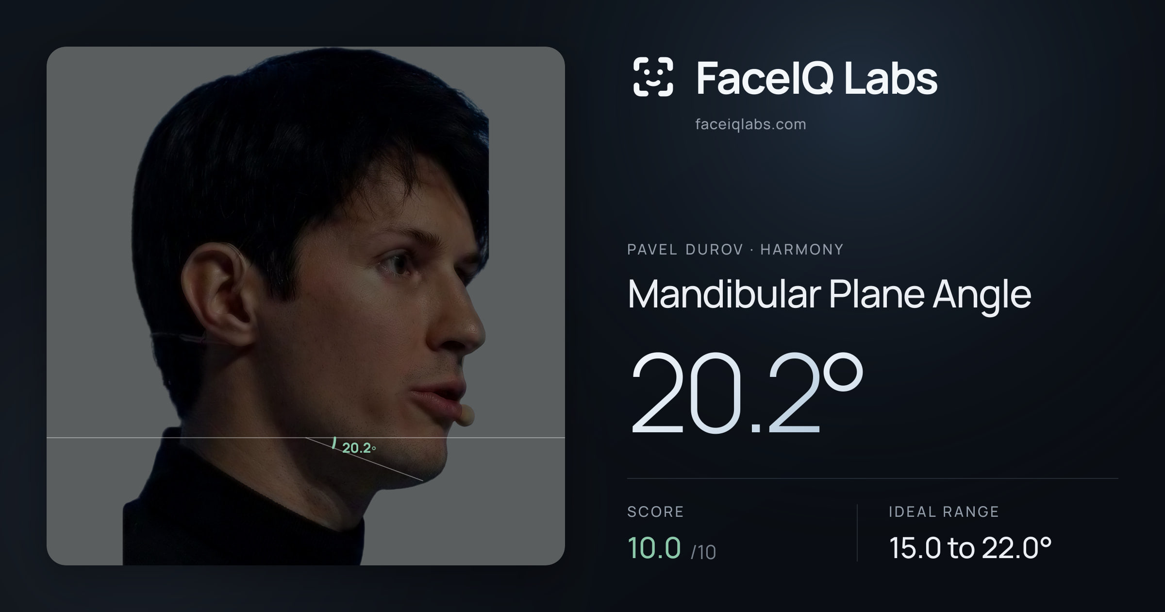 Pavel Durov Mandibular Plane Angle: 20.2°, drawn on the photo