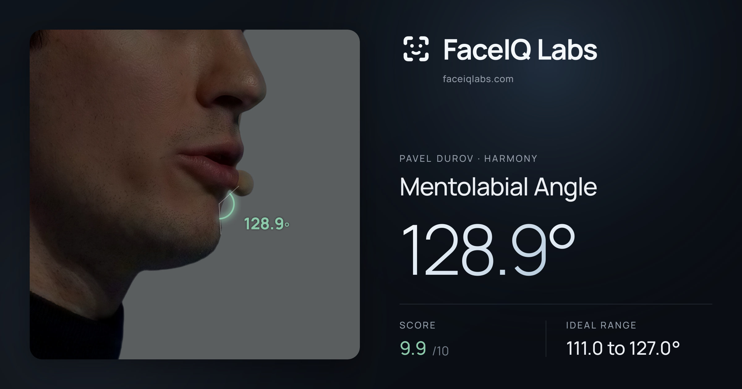 Pavel Durov Mentolabial Angle: 128.9°, drawn on the photo