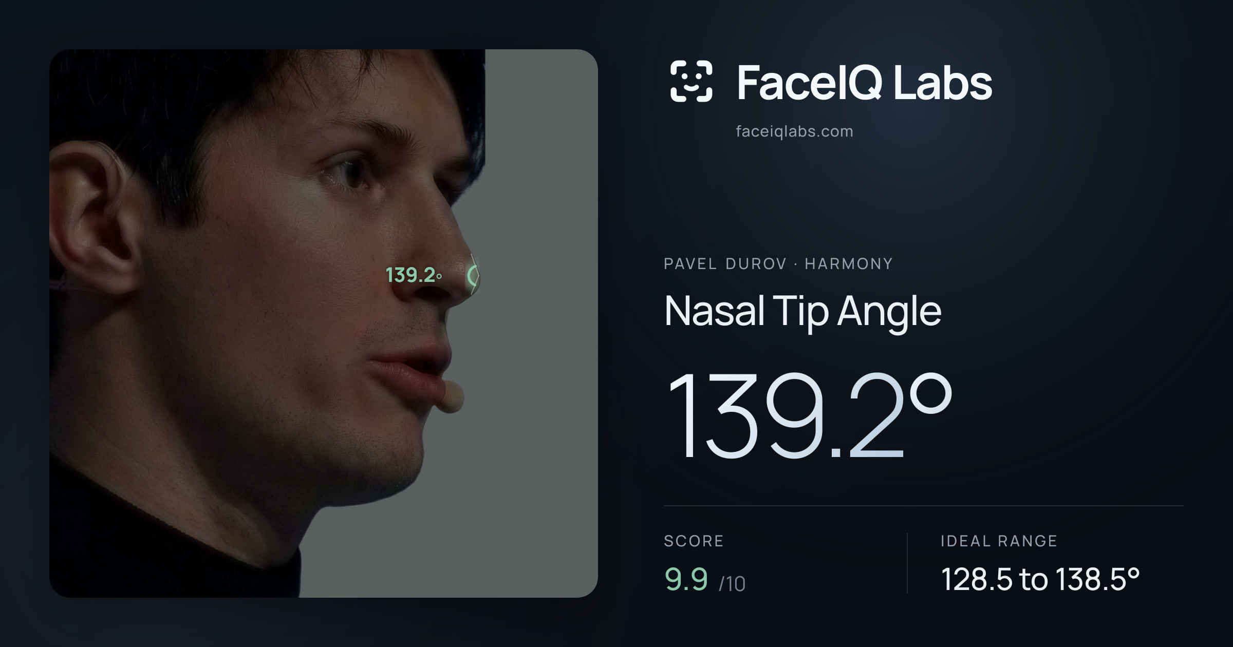 Pavel Durov Nasal Tip Angle: 139.2°, drawn on the photo