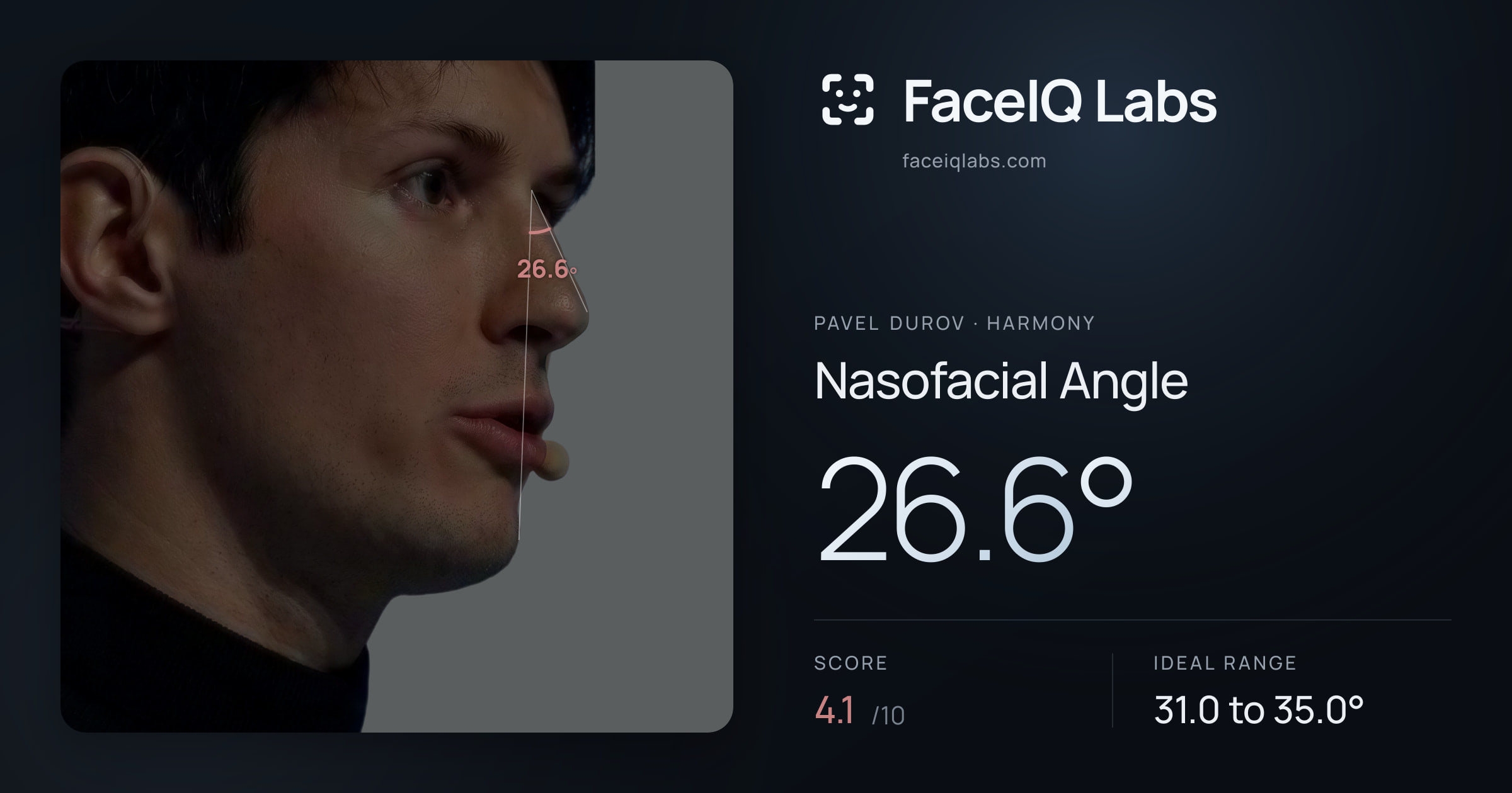 Pavel Durov Nasofacial Angle: 26.6°, drawn on the photo
