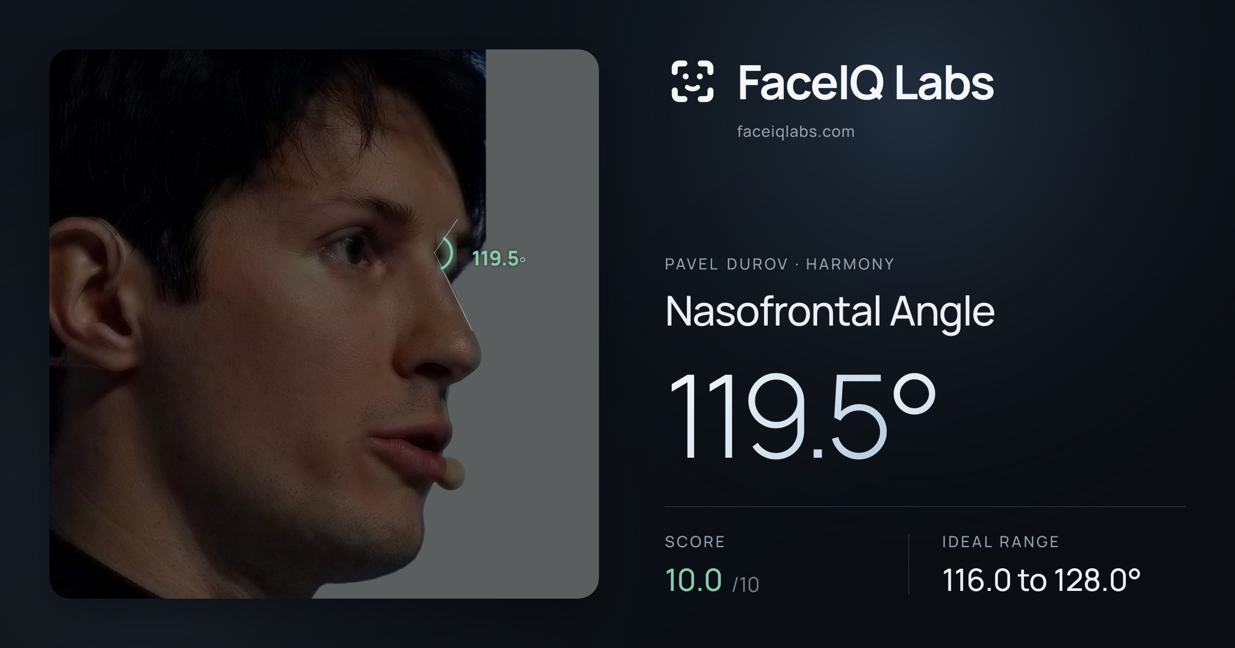 Pavel Durov Nasofrontal Angle: 119.5°, drawn on the photo