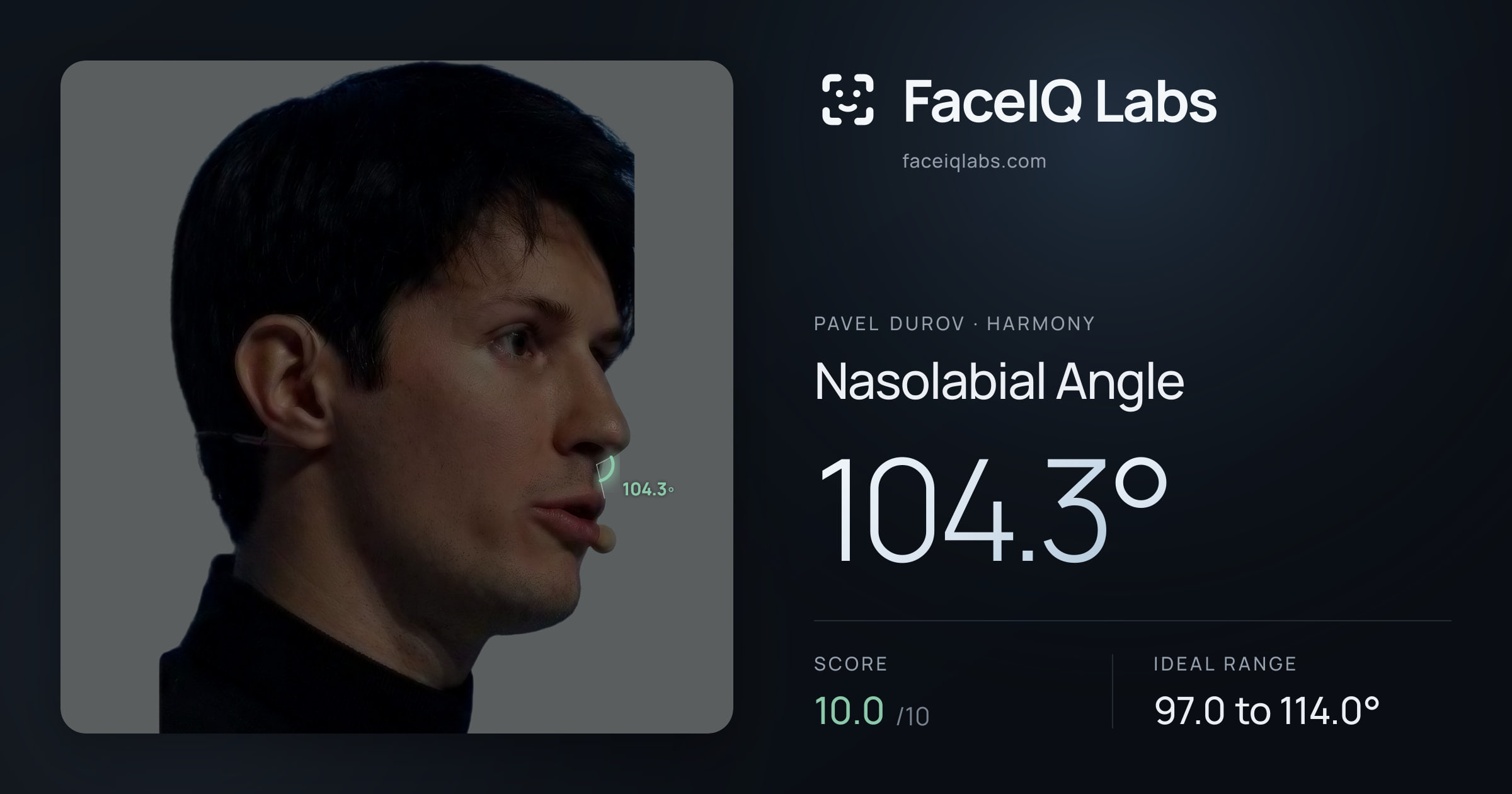 Pavel Durov Nasolabial Angle: 104.3°, drawn on the photo