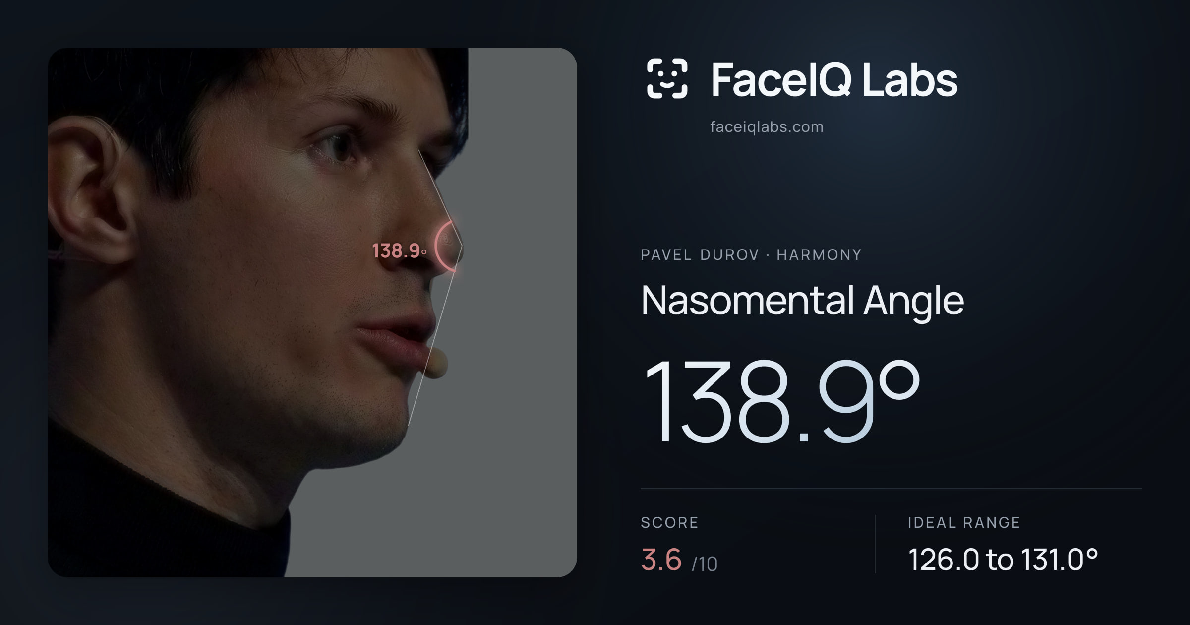 Pavel Durov Nasomental Angle: 138.9°, drawn on the photo
