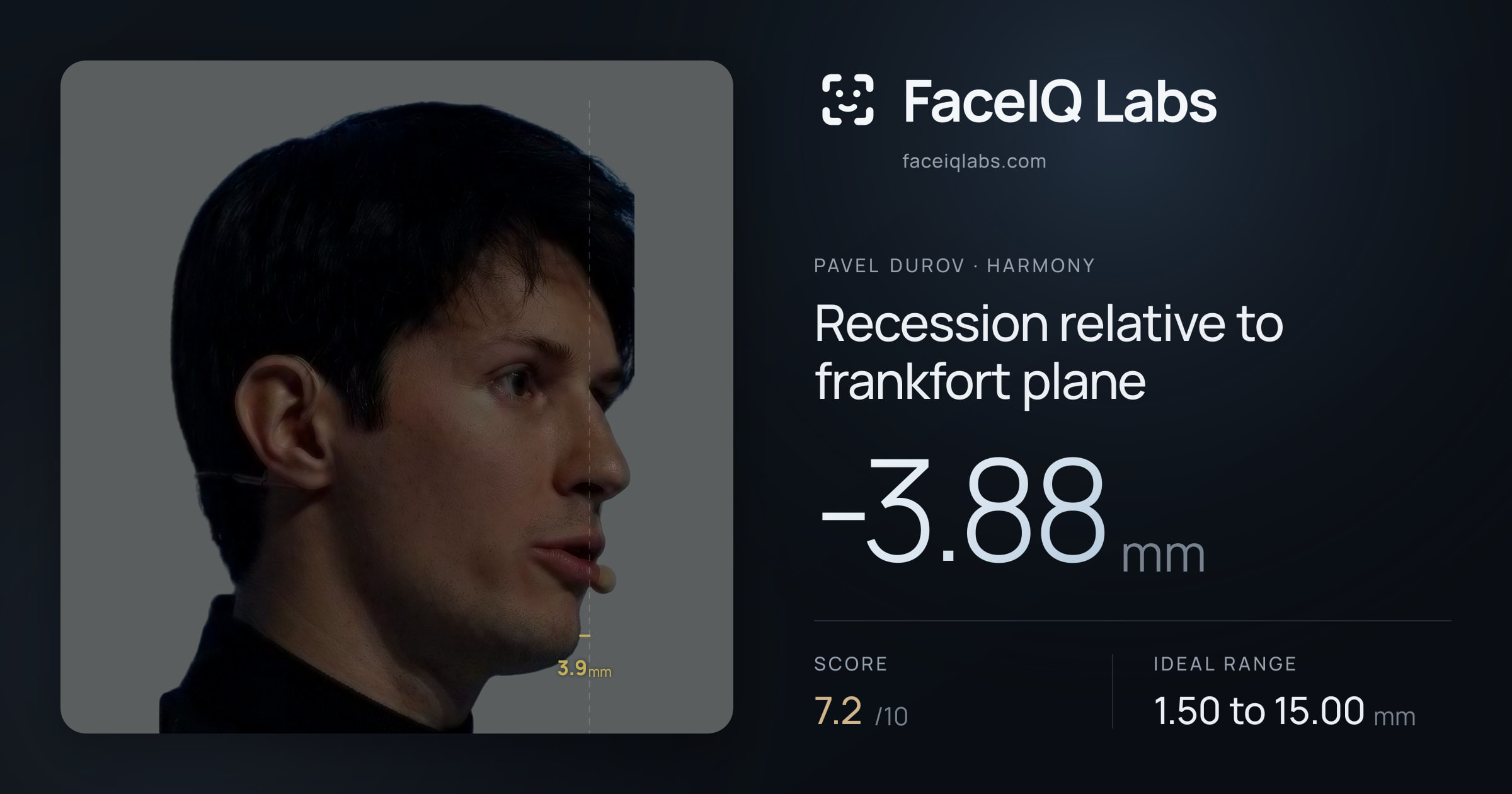 Pavel Durov Recession relative to frankfort plane: -3.88mm, drawn on the photo