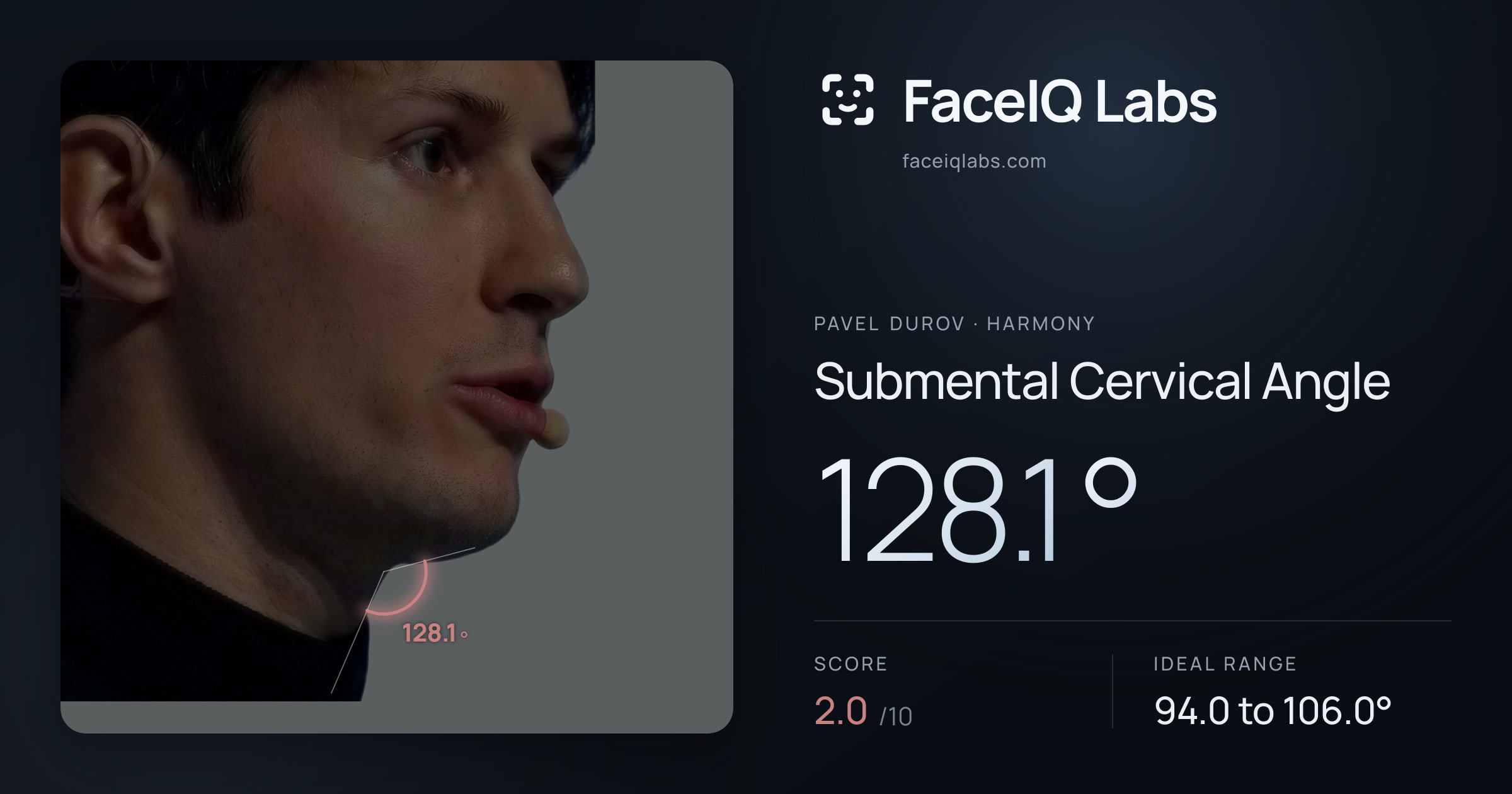 Pavel Durov Submental Cervical Angle: 128.1°, drawn on the photo