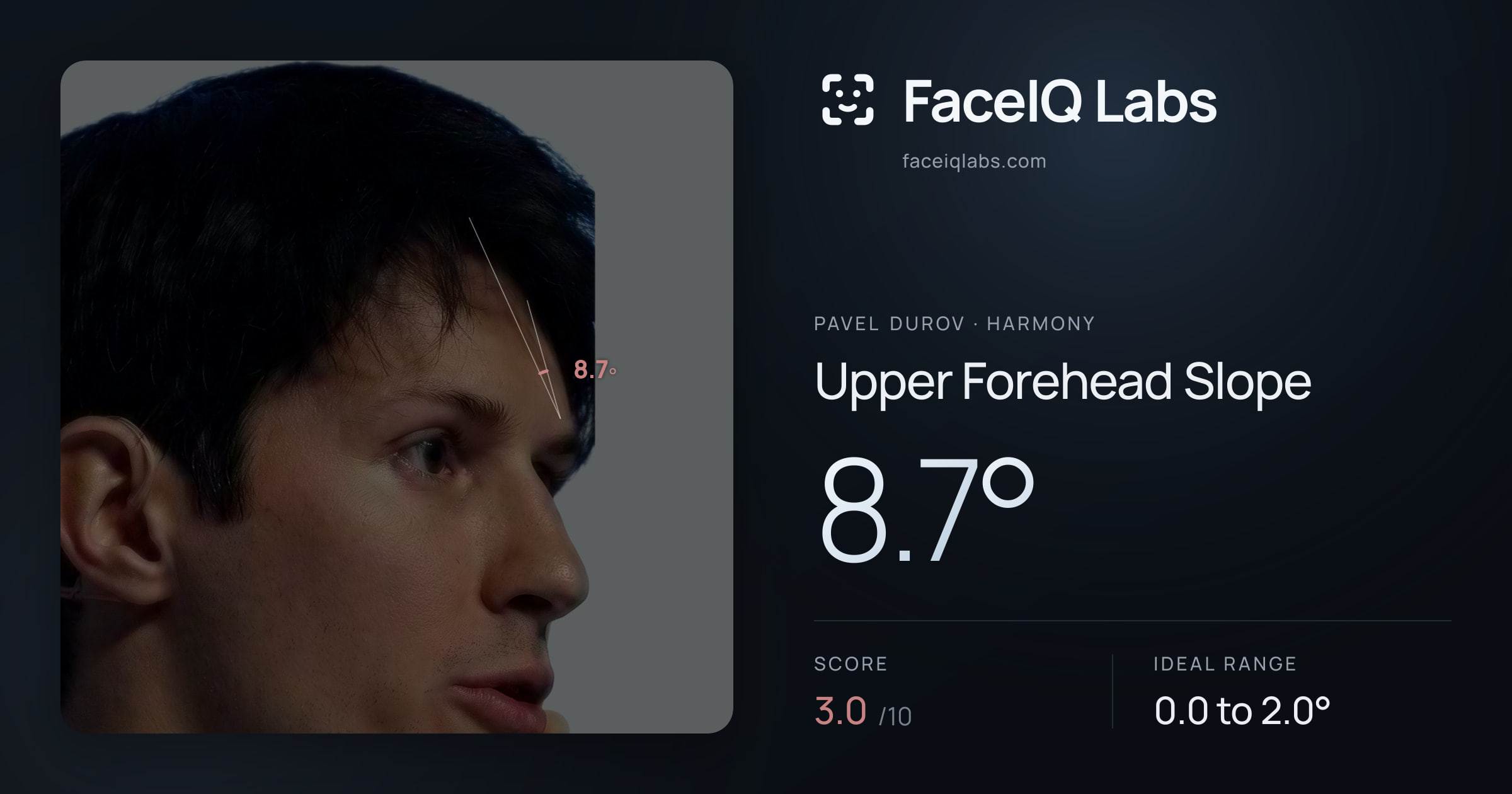 Pavel Durov Upper Forehead Slope: 8.7°, drawn on the photo