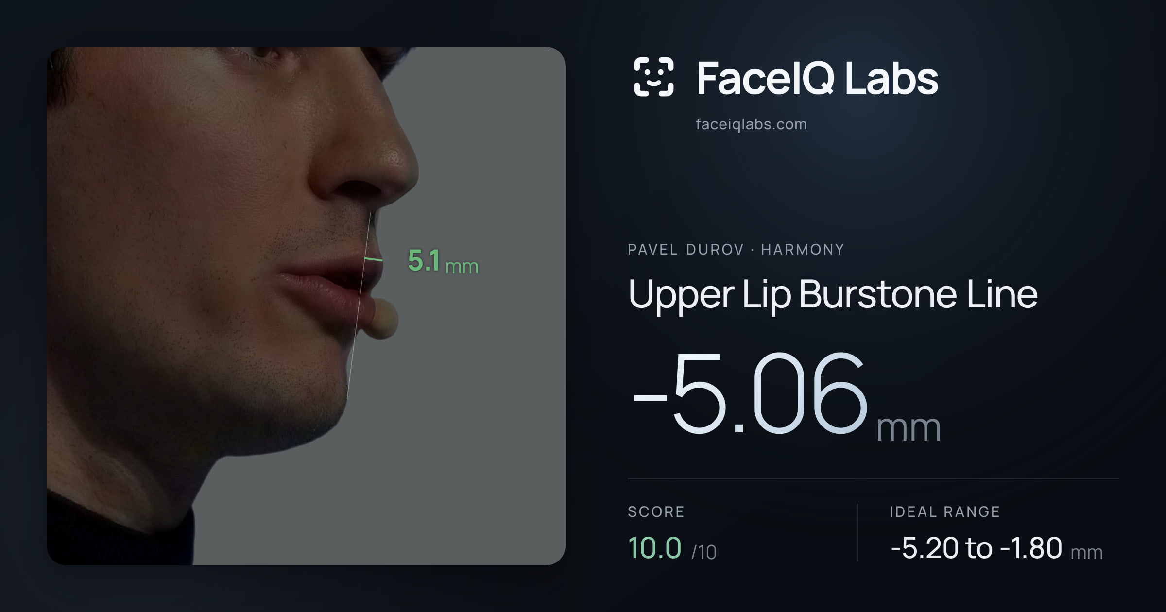 Pavel Durov Upper Lip Burstone Line: -5.06mm, drawn on the photo