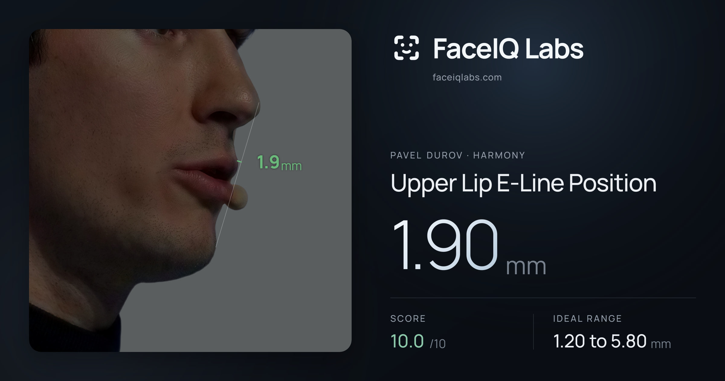 Pavel Durov Upper Lip E-Line Position: 1.90mm, drawn on the photo