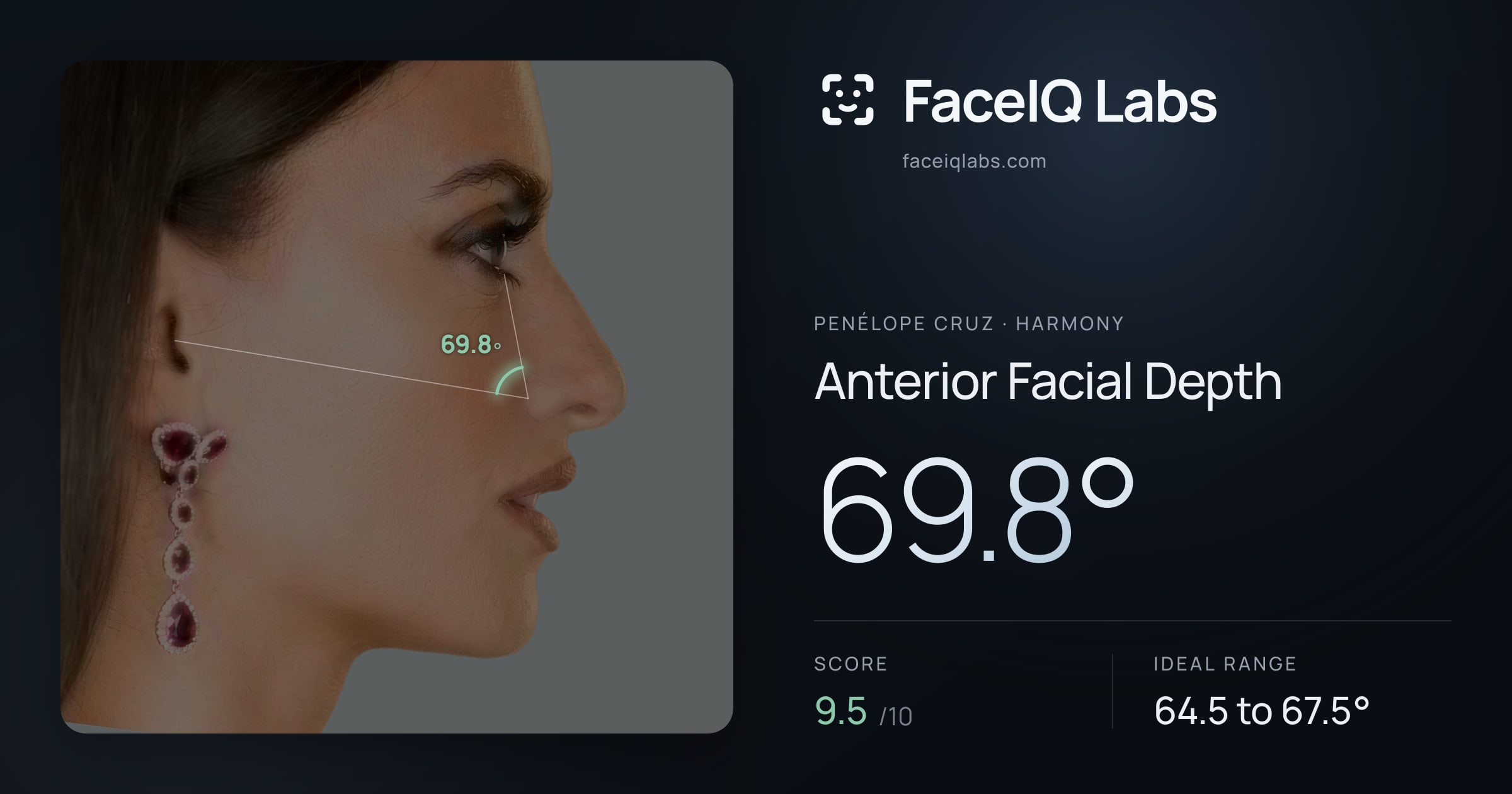 penélope cruz Anterior Facial Depth: 69.8°, drawn on the photo