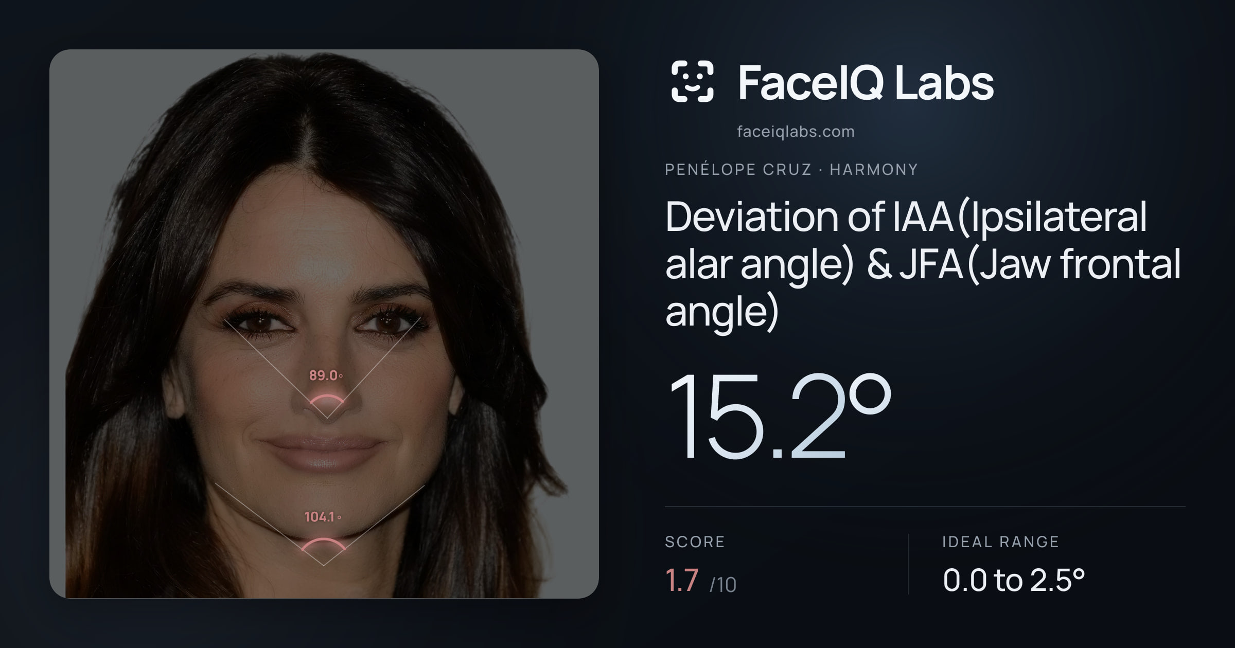 Penélope Cruz Deviation of IAA(Ipsilateral alar angle) & JFA(Jaw frontal angle): 15.2°, drawn on the photo