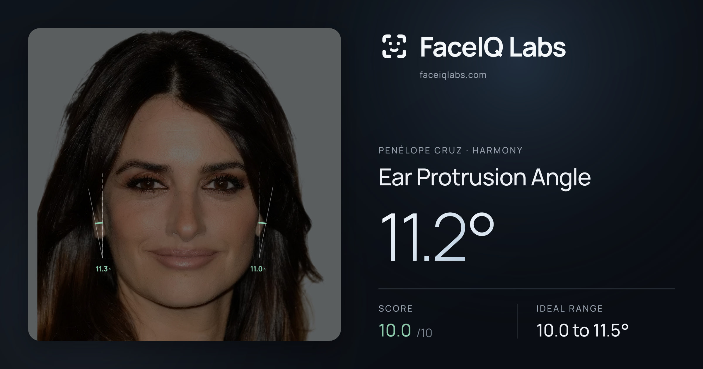 Penélope Cruz Ear Protrusion Angle: 11.2°, drawn on the photo