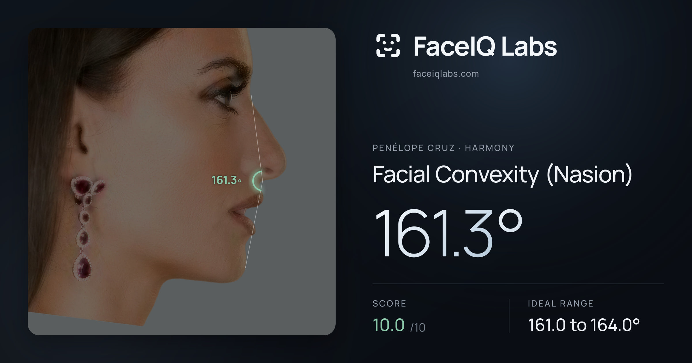 penélope cruz Facial Convexity (Nasion): 161.3°, drawn on the photo