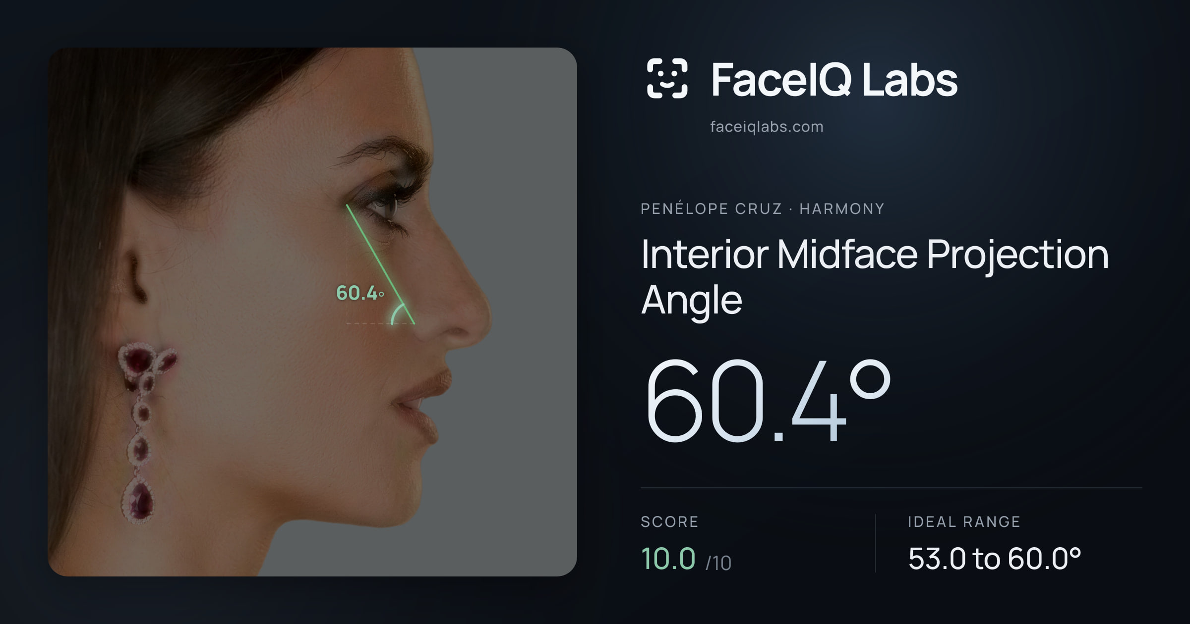 penélope cruz Interior Midface Projection Angle: 60.4°, drawn on the photo