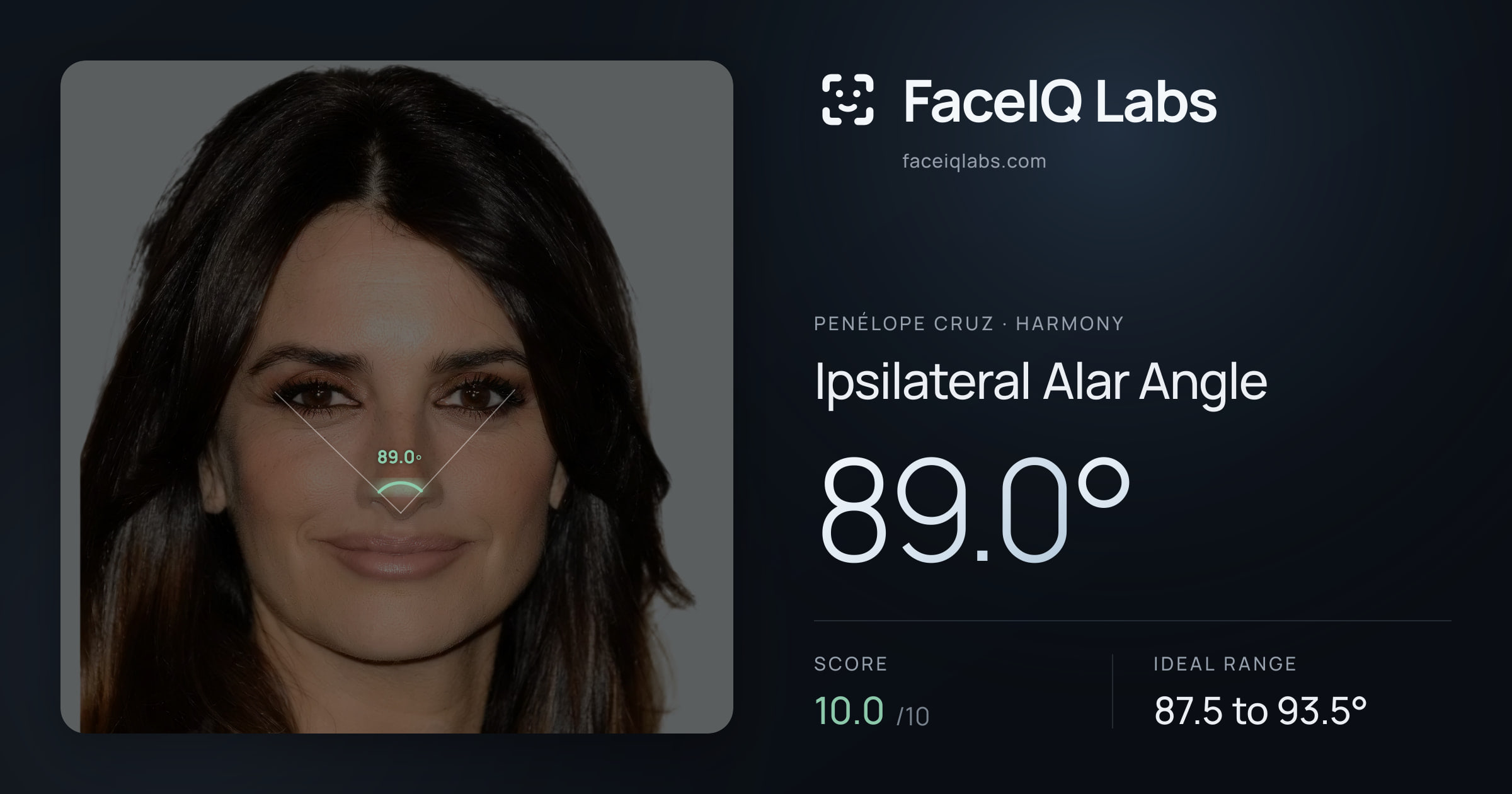 penélope cruz Ipsilateral Alar Angle: 89.0°, drawn on the photo