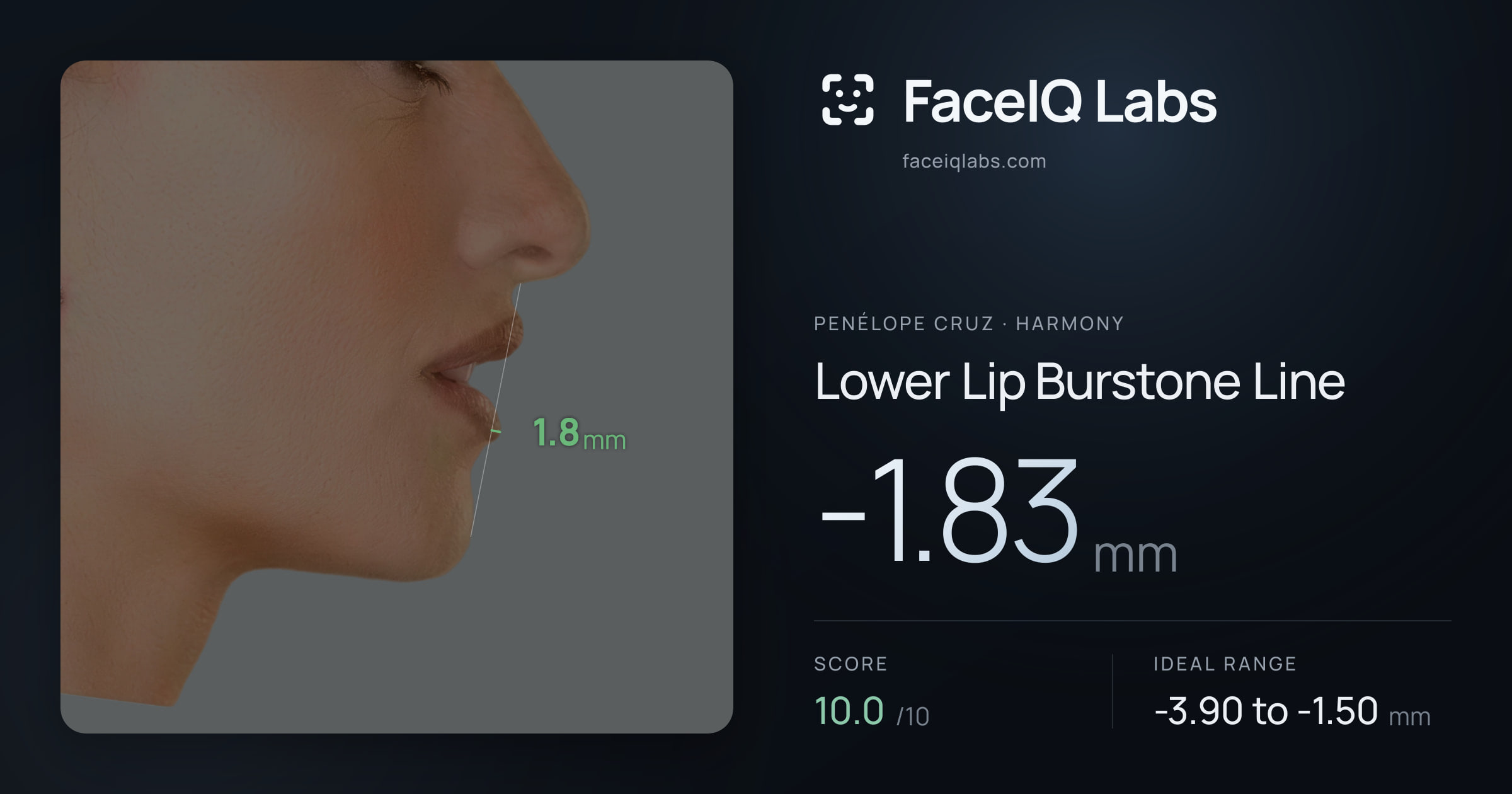 penélope cruz Lower Lip Burstone Line: -1.83mm, drawn on the photo