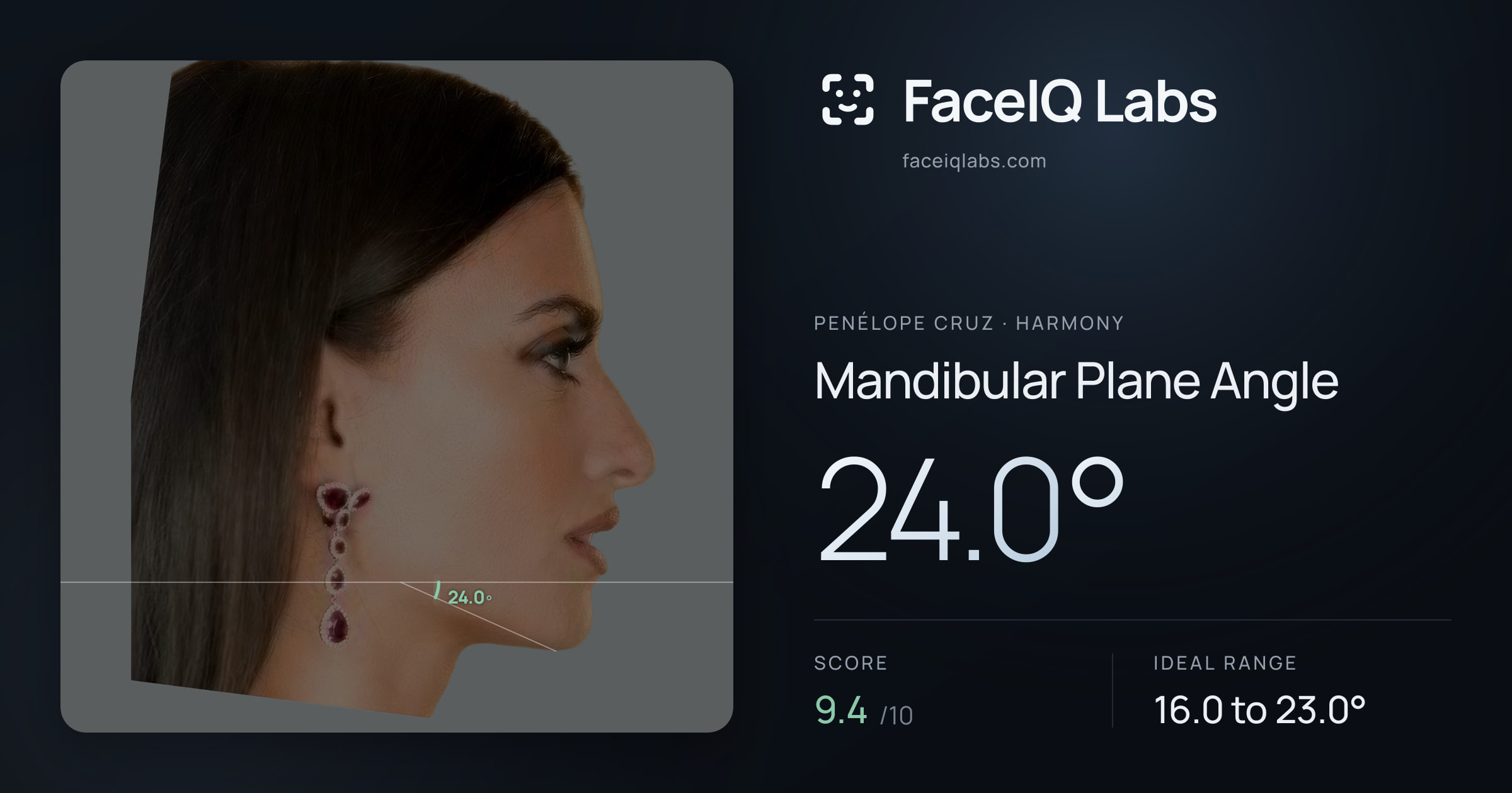 penélope cruz Mandibular Plane Angle: 24.0°, drawn on the photo