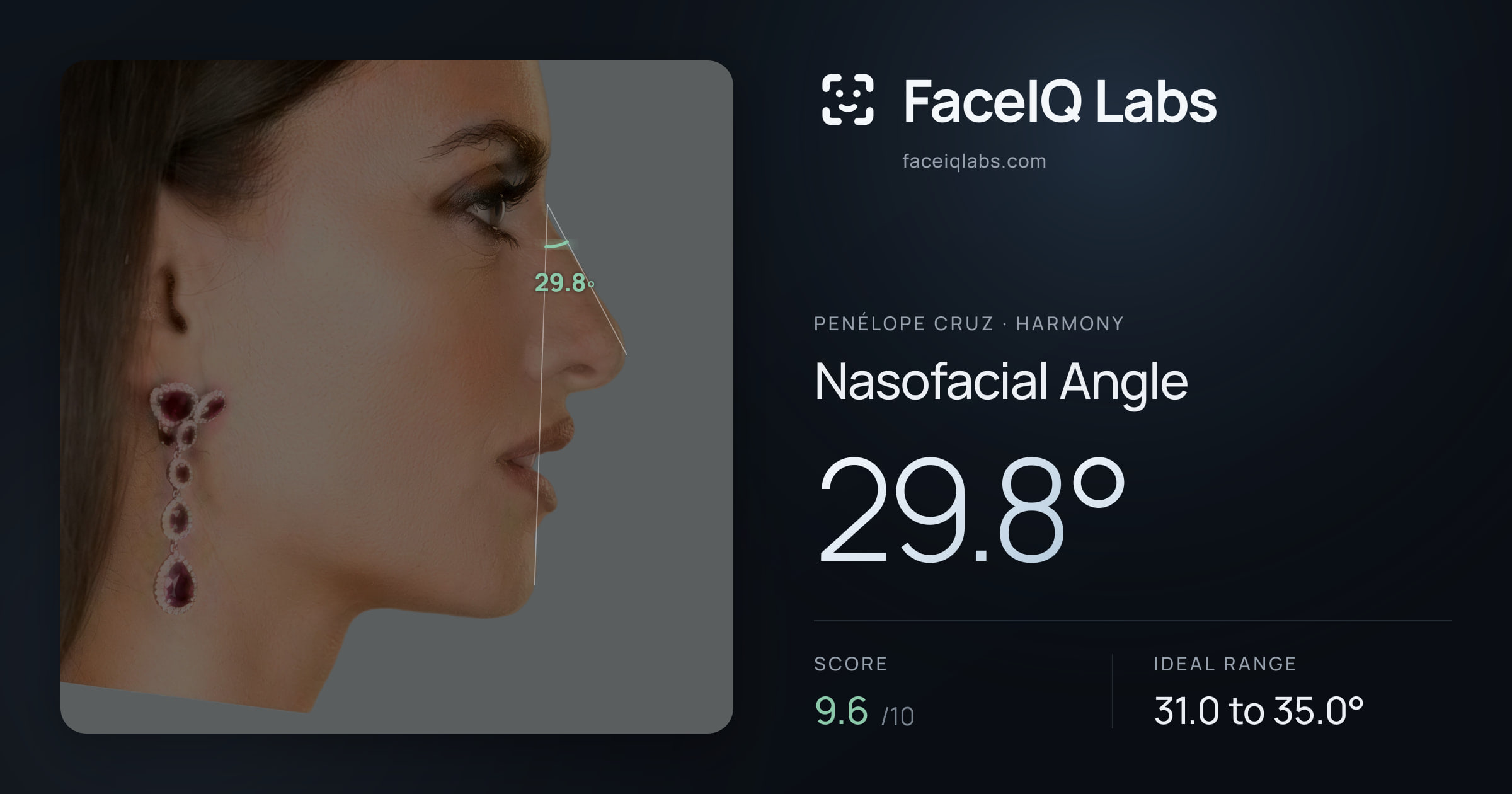 penélope cruz Nasofacial Angle: 29.8°, drawn on the photo