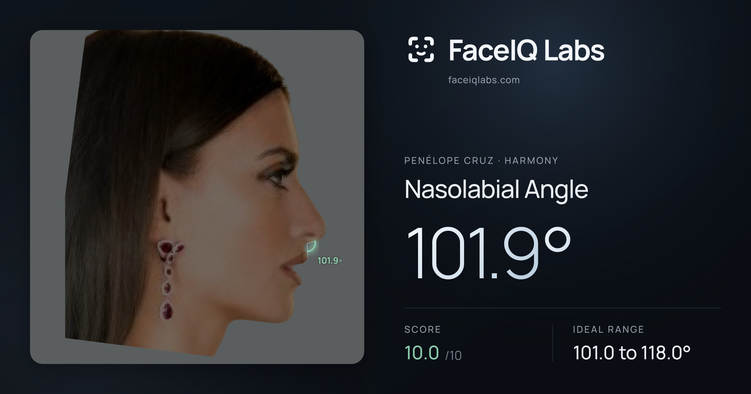 penélope cruz Nasolabial Angle: 101.9°, drawn on the photo
