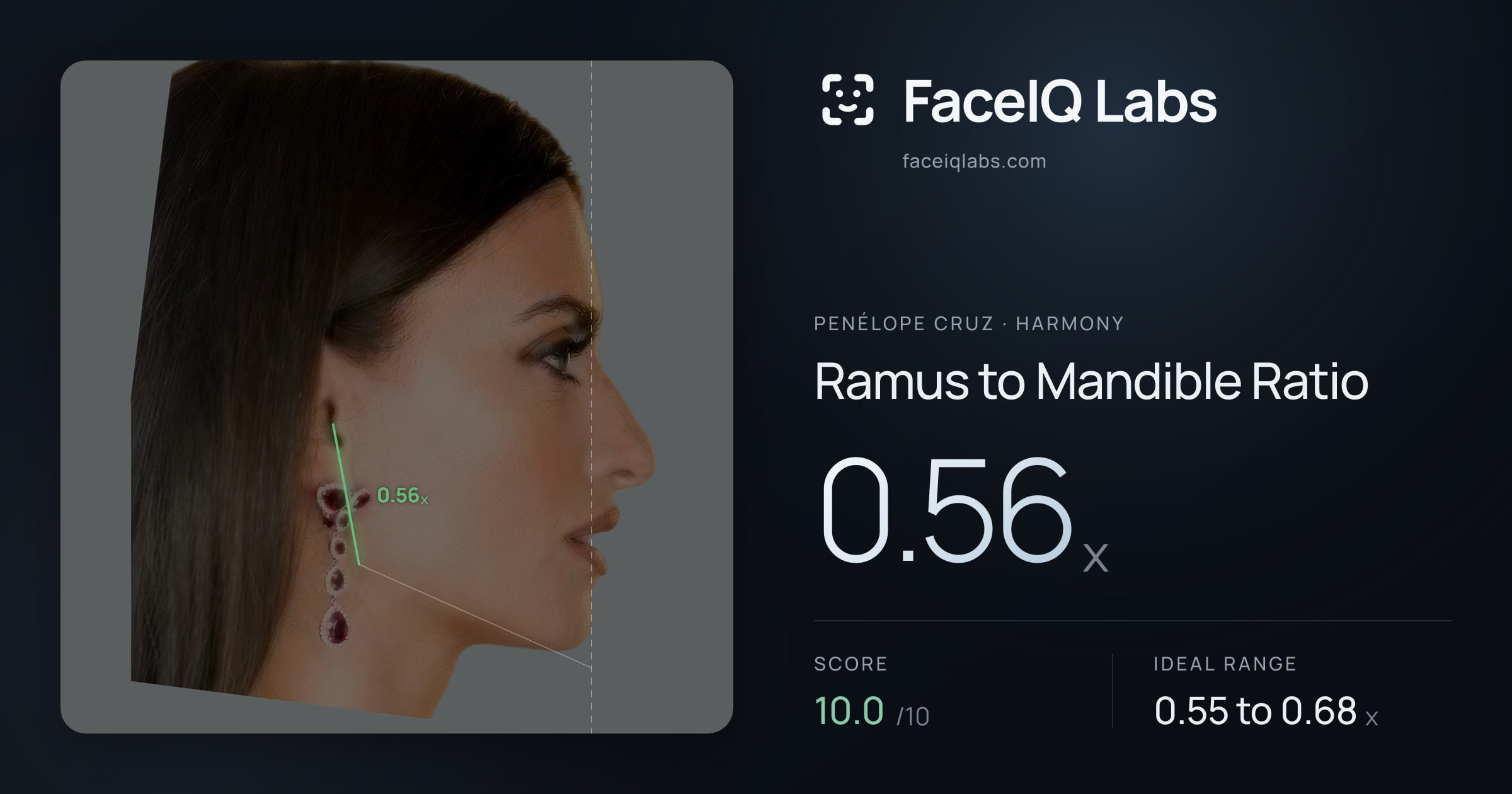 penélope cruz Ramus to Mandible Ratio: 0.56x, drawn on the photo
