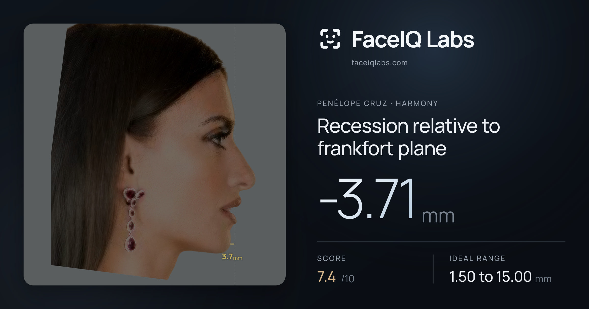 penélope cruz Recession relative to frankfort plane: -3.71mm, drawn on the photo