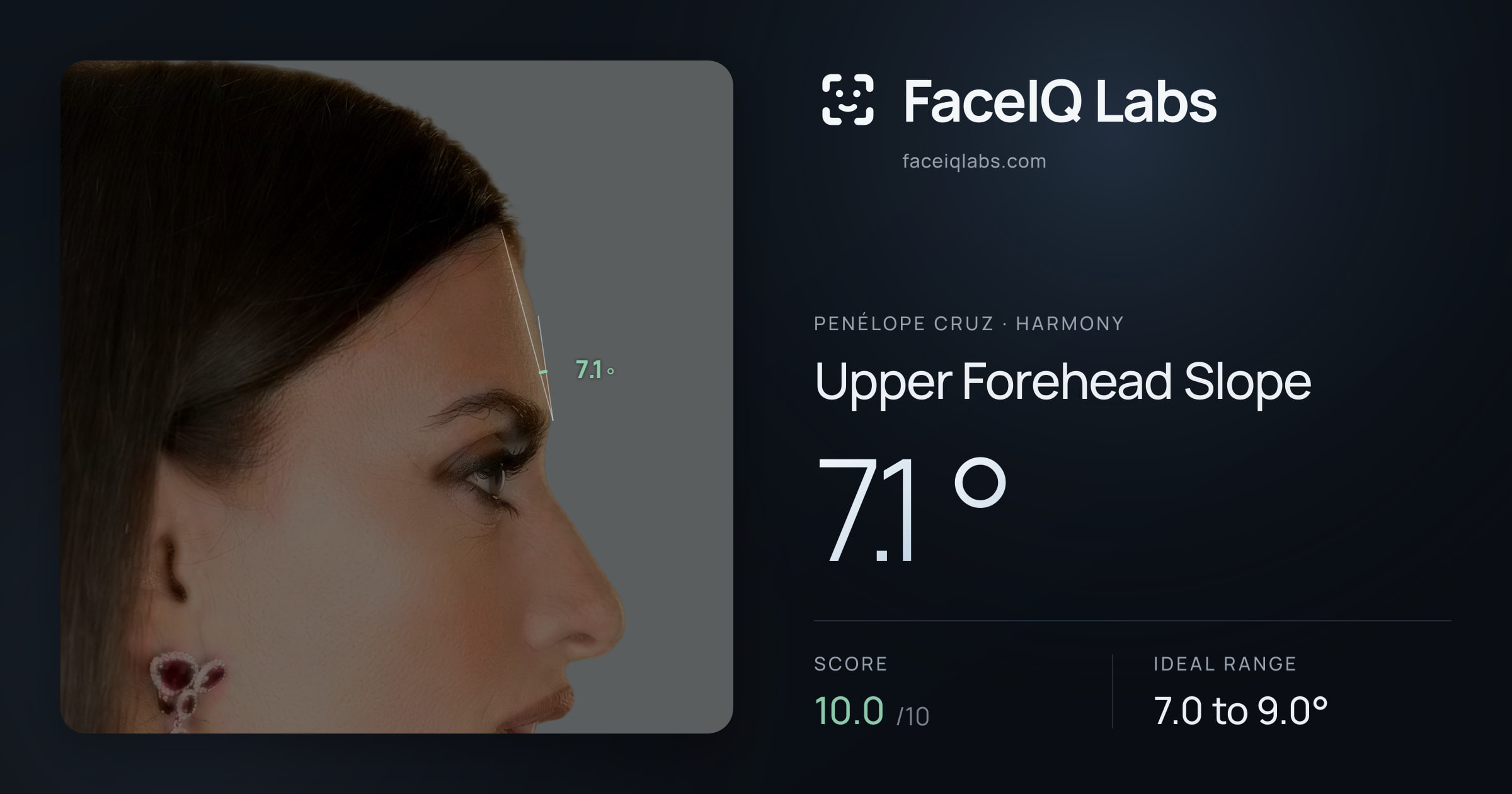 penélope cruz Upper Forehead Slope: 7.1°, drawn on the photo