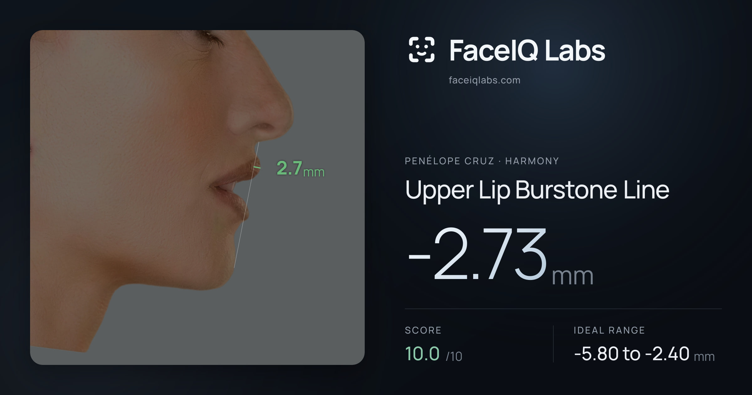 penélope cruz Upper Lip Burstone Line: -2.73mm, drawn on the photo