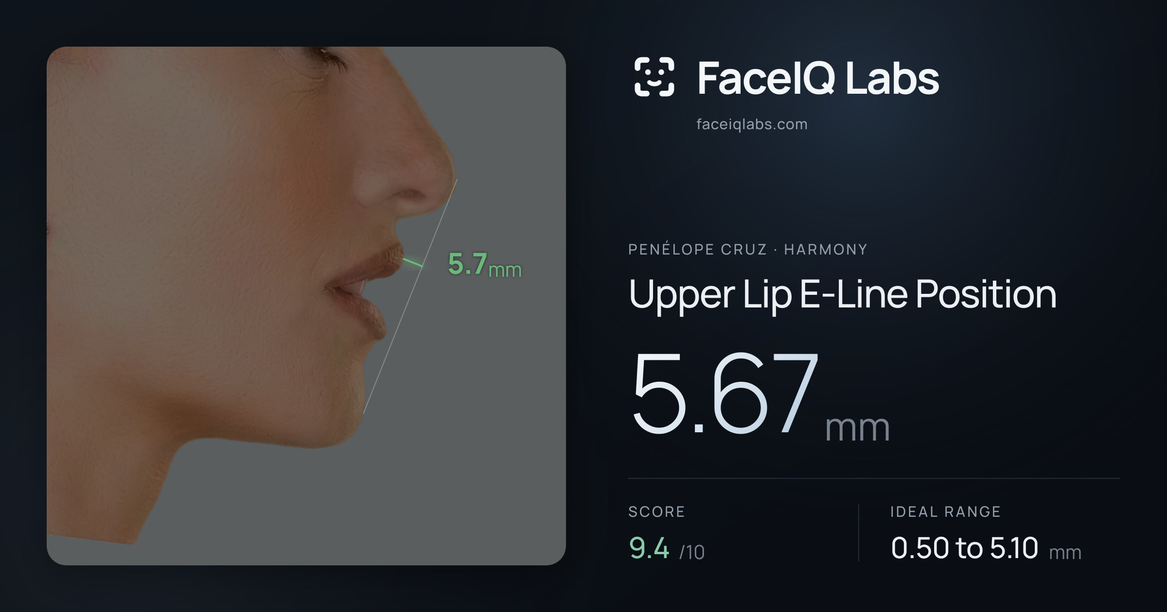 penélope cruz Upper Lip E-Line Position: 5.67mm, drawn on the photo