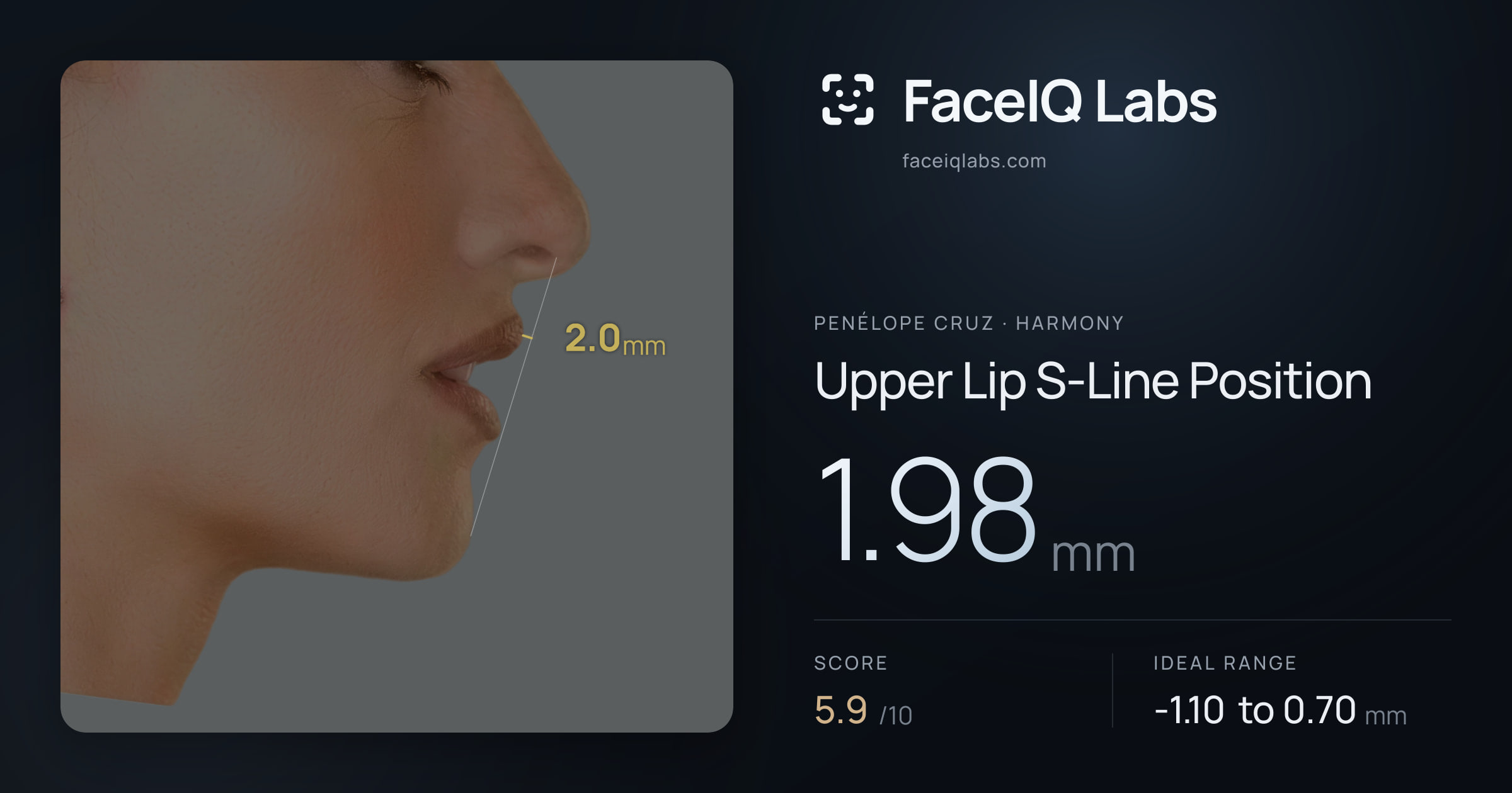 penélope cruz Upper Lip S-Line Position: 1.98mm, drawn on the photo