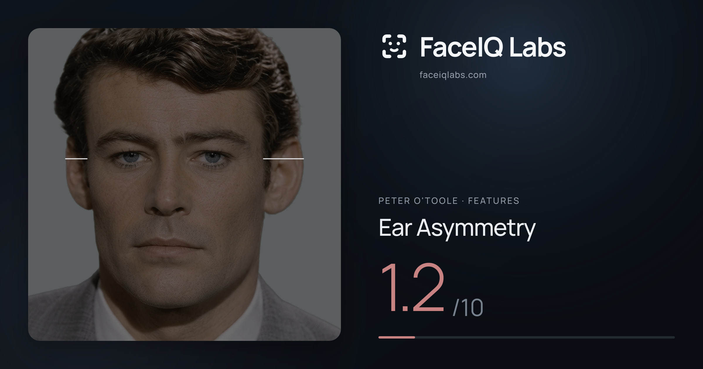 Peter O'Toole Ear Asymmetry: 1.2/10, drawn on the photo