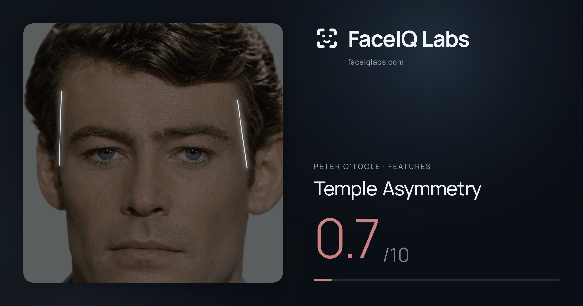 Peter O'Toole Temple Asymmetry: 0.7/10, drawn on the photo