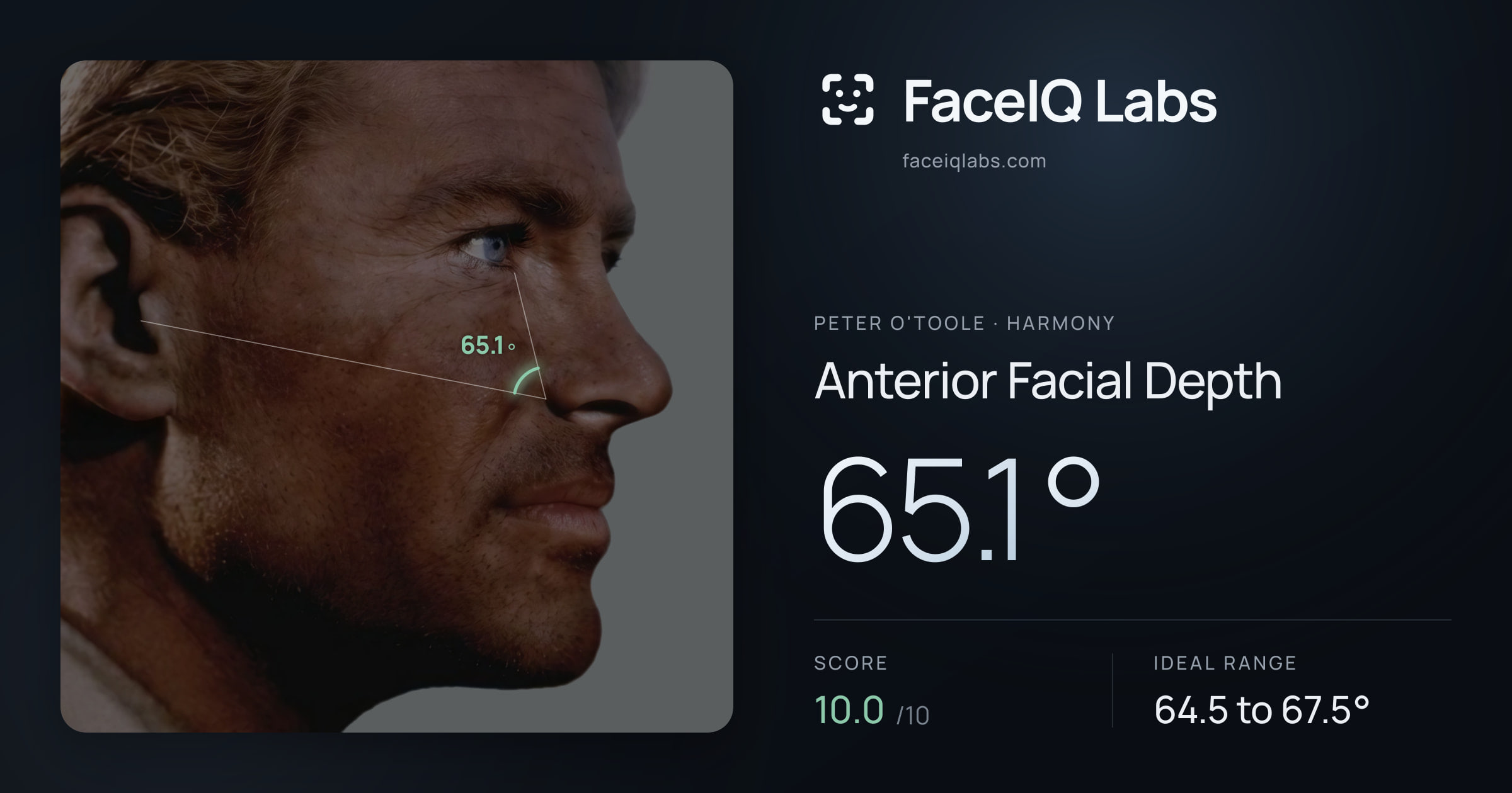 Peter O'Toole Anterior Facial Depth: 65.1°, drawn on the photo