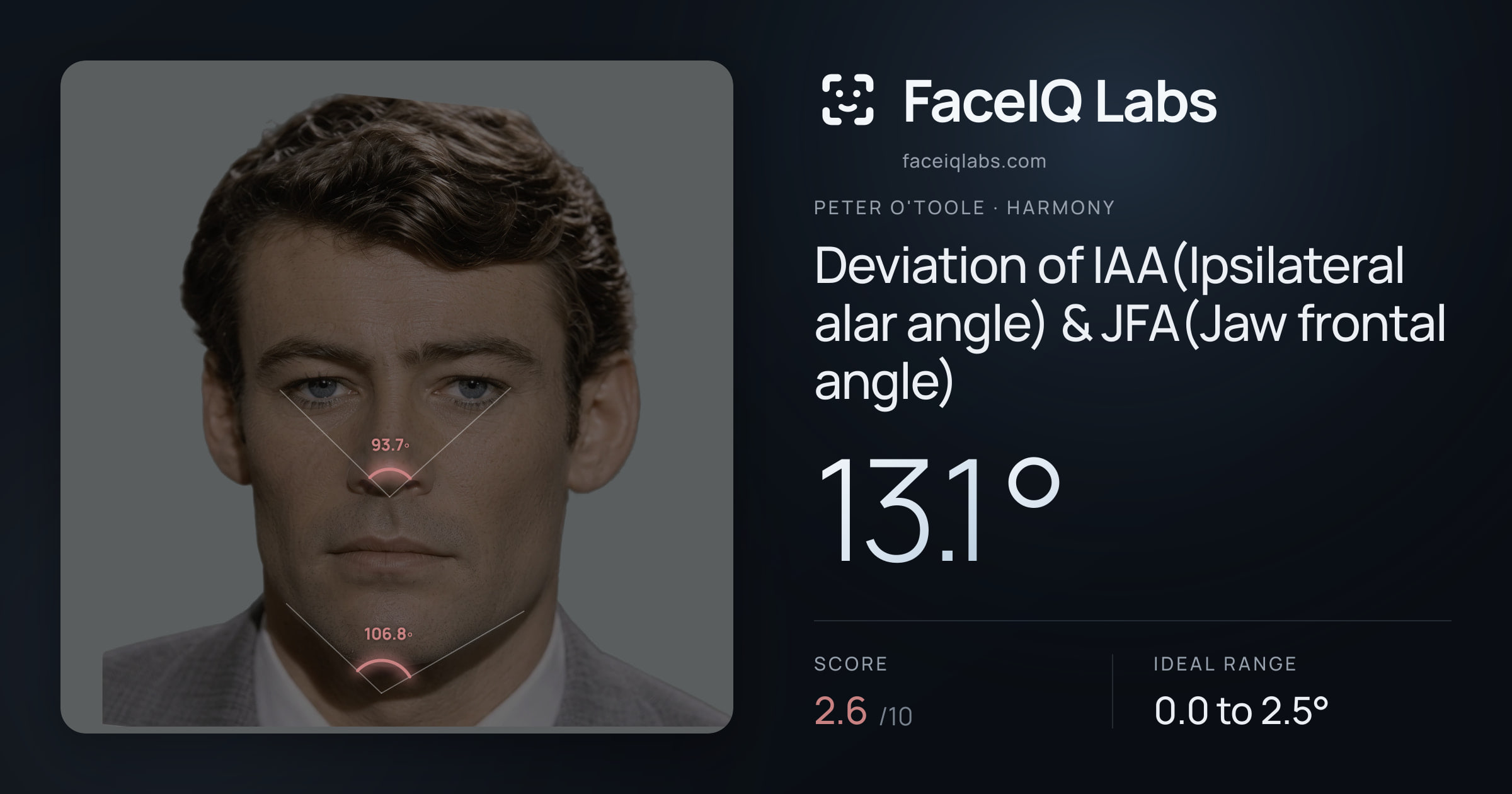Peter O'Toole Deviation of IAA(Ipsilateral alar angle) & JFA(Jaw frontal angle): 13.1°, drawn on the photo