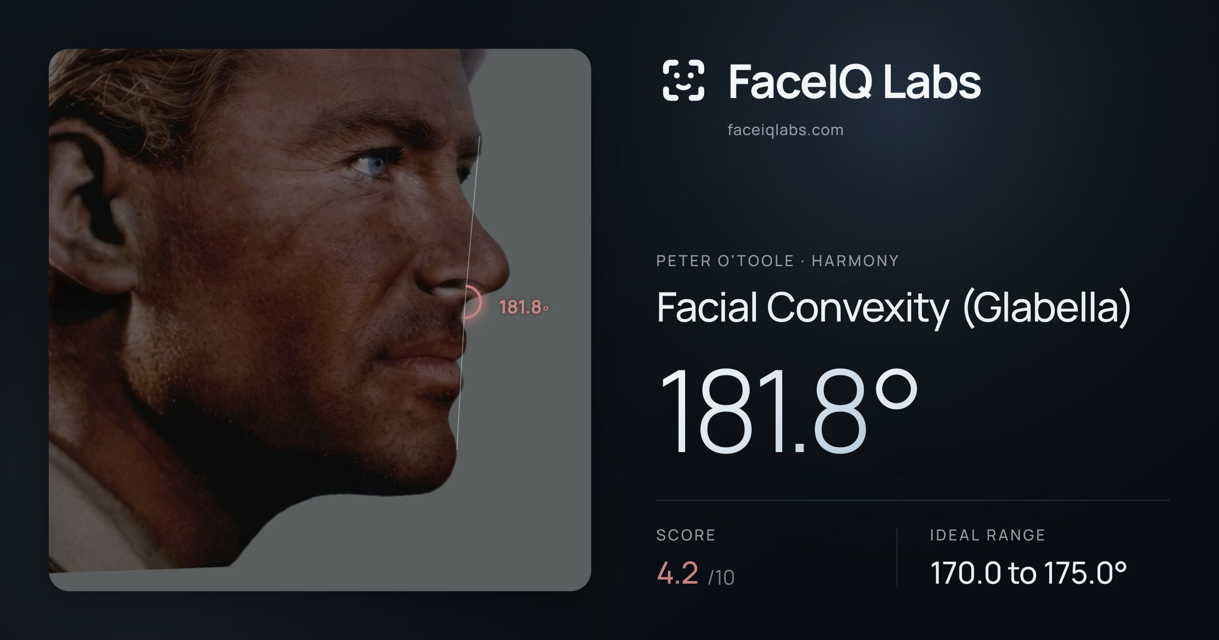 Peter O'Toole Facial Convexity (Glabella): 181.8°, drawn on the photo