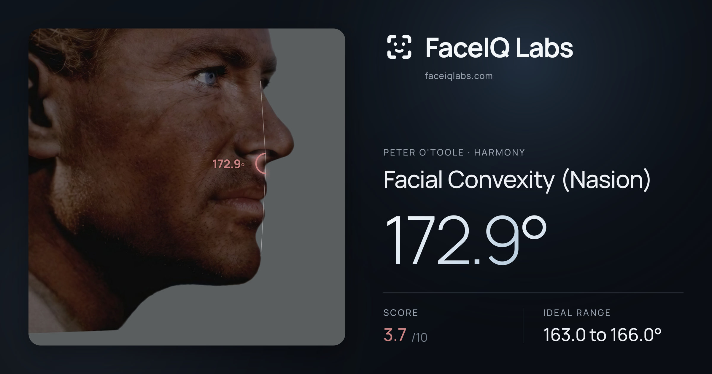 Peter O'Toole Facial Convexity (Nasion): 172.9°, drawn on the photo