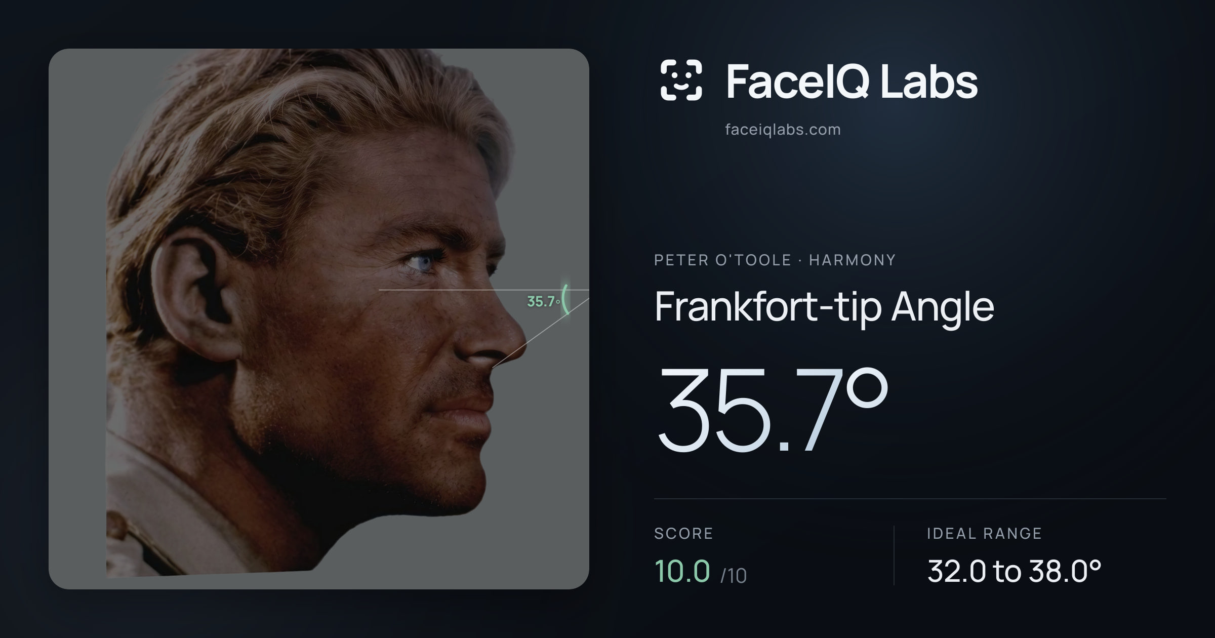 Peter O'Toole Frankfort-tip Angle: 35.7°, drawn on the photo
