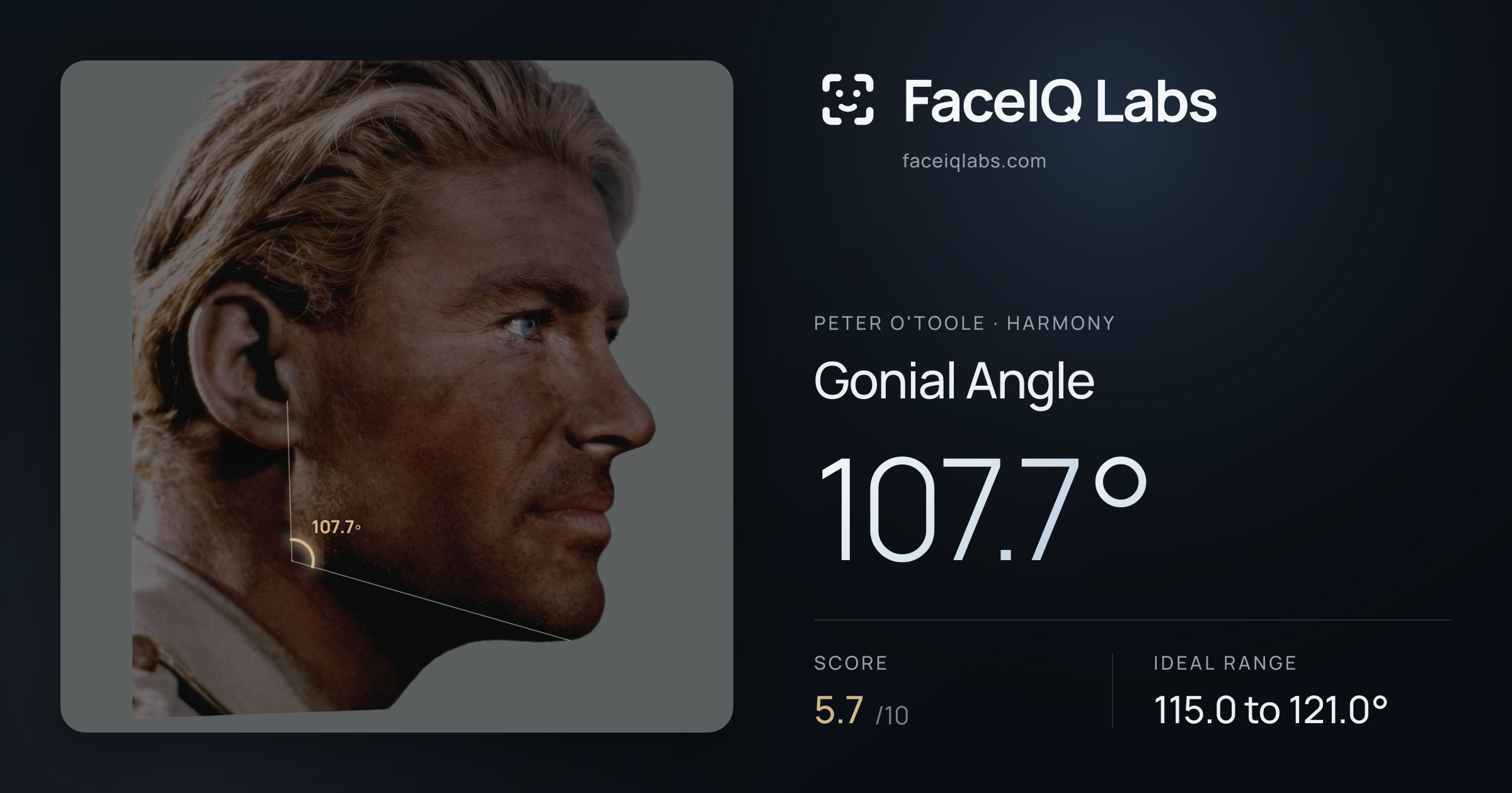 Peter O'Toole Gonial Angle: 107.7°, drawn on the photo