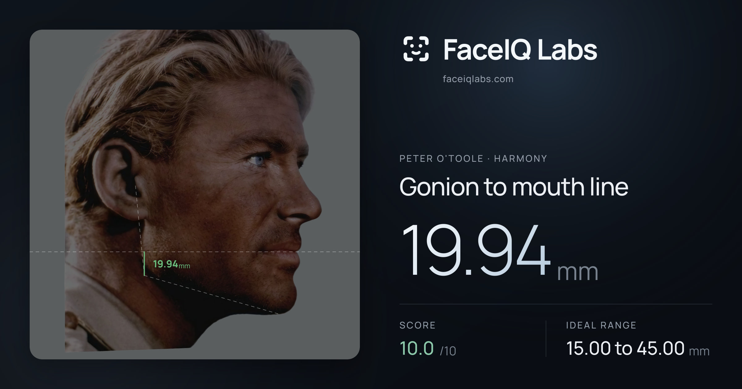 Peter O'Toole Gonion to mouth line: 19.94mm, drawn on the photo
