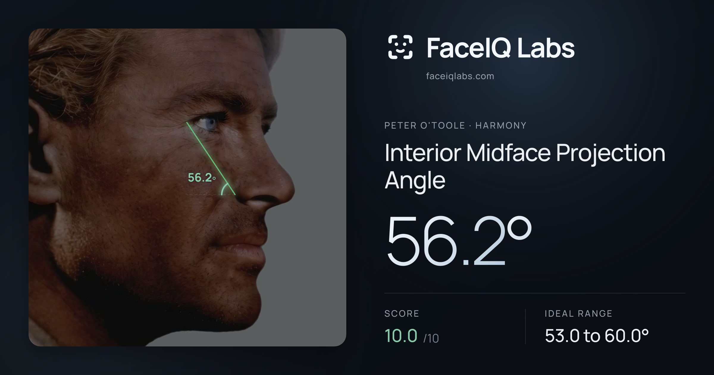 Peter O'Toole Interior Midface Projection Angle: 56.2°, drawn on the photo