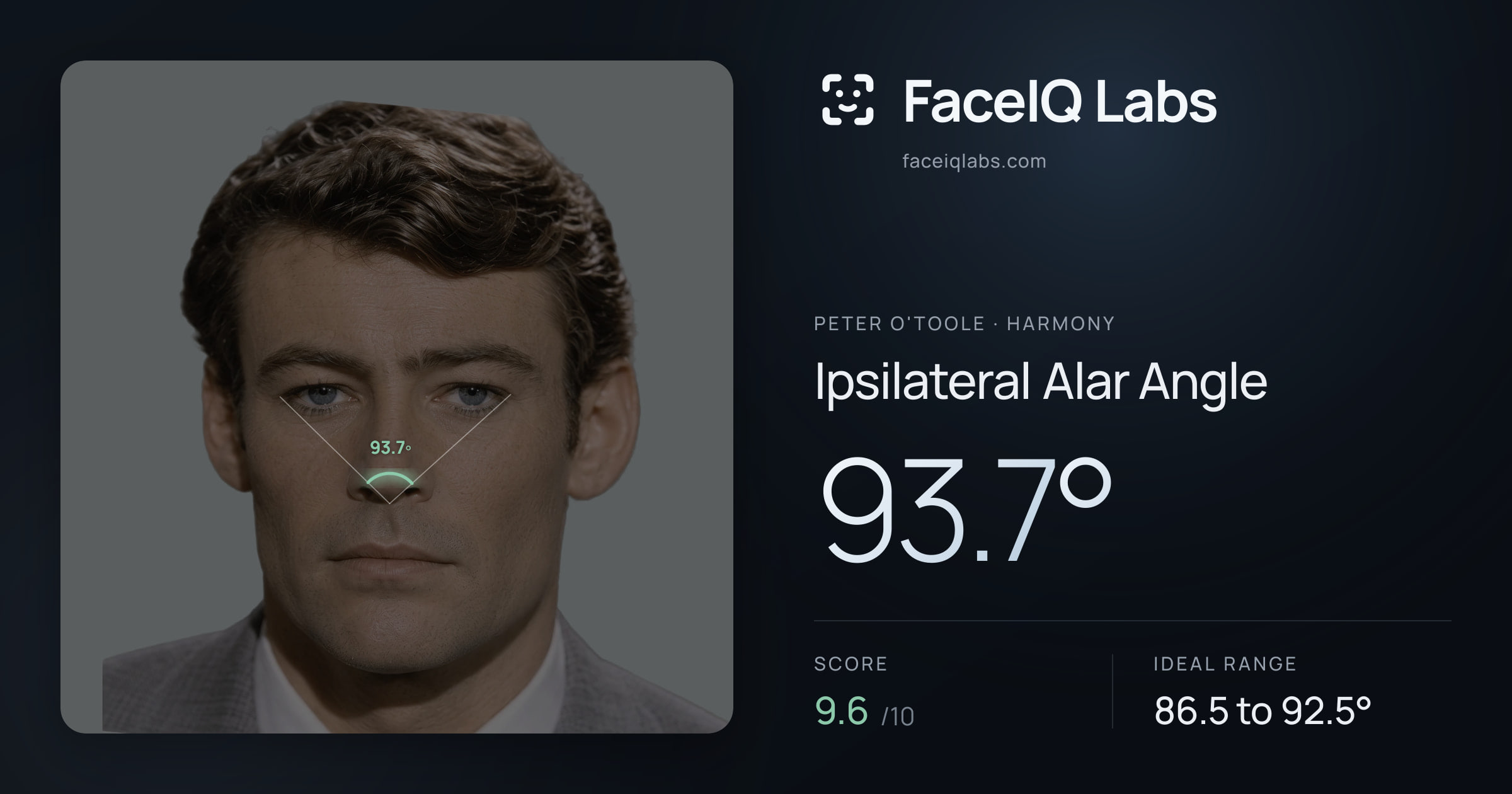 Peter O'Toole Ipsilateral Alar Angle: 93.7°, drawn on the photo