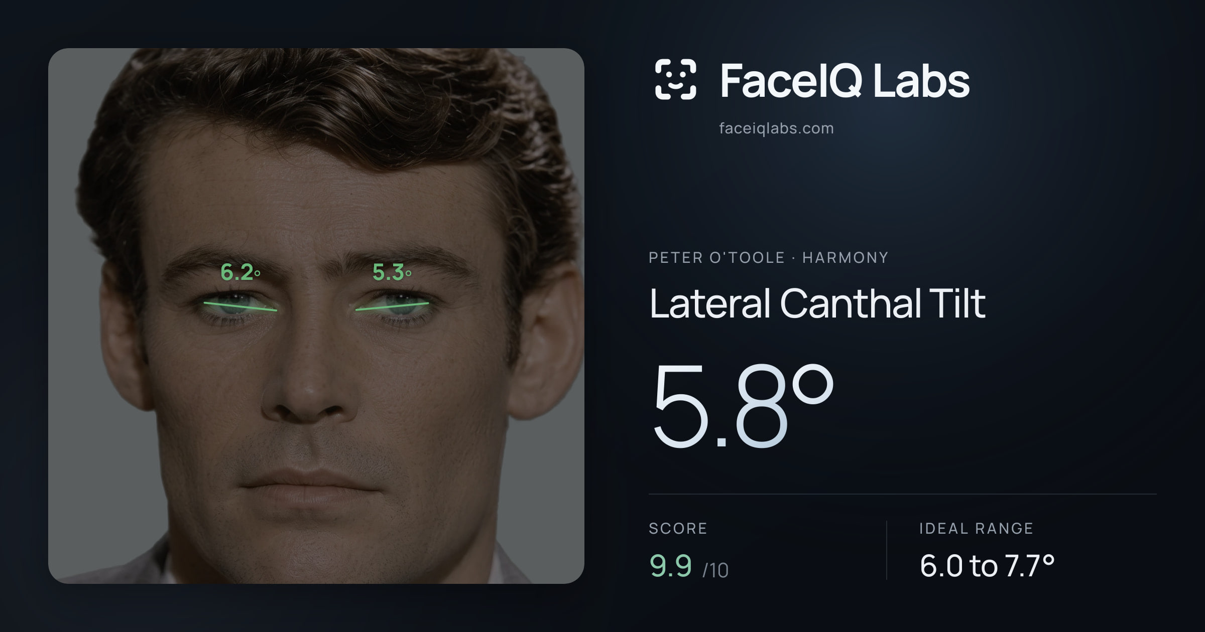 Peter O'Toole Lateral Canthal Tilt: 5.8°, drawn on the photo