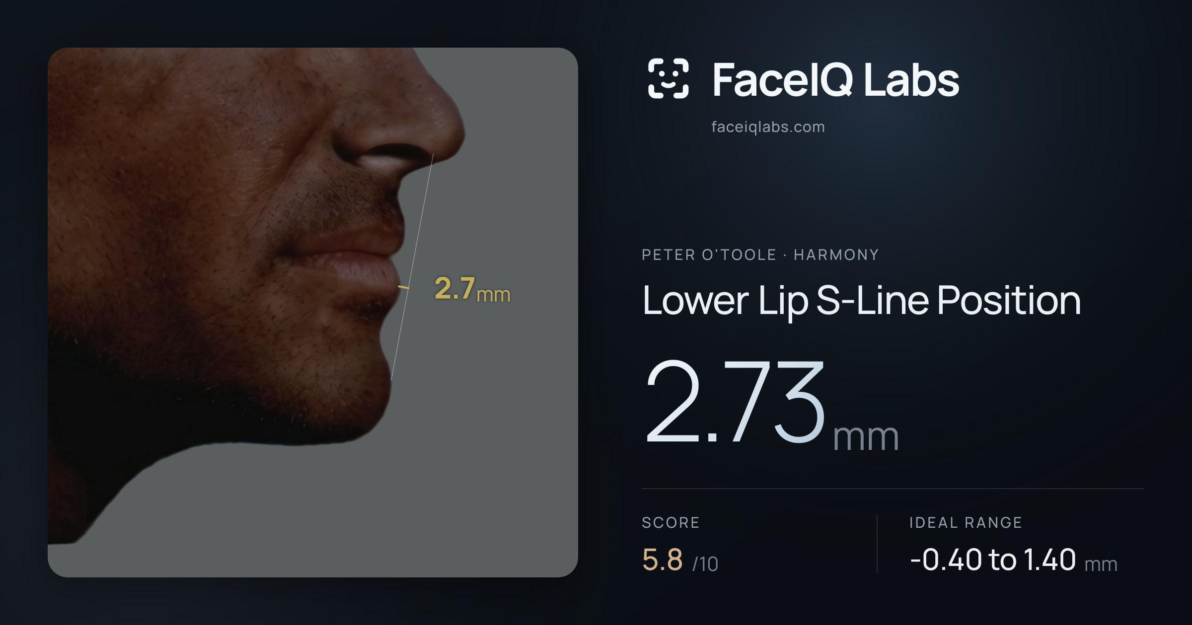 Peter O'Toole Lower Lip S-Line Position: 2.73mm, drawn on the photo