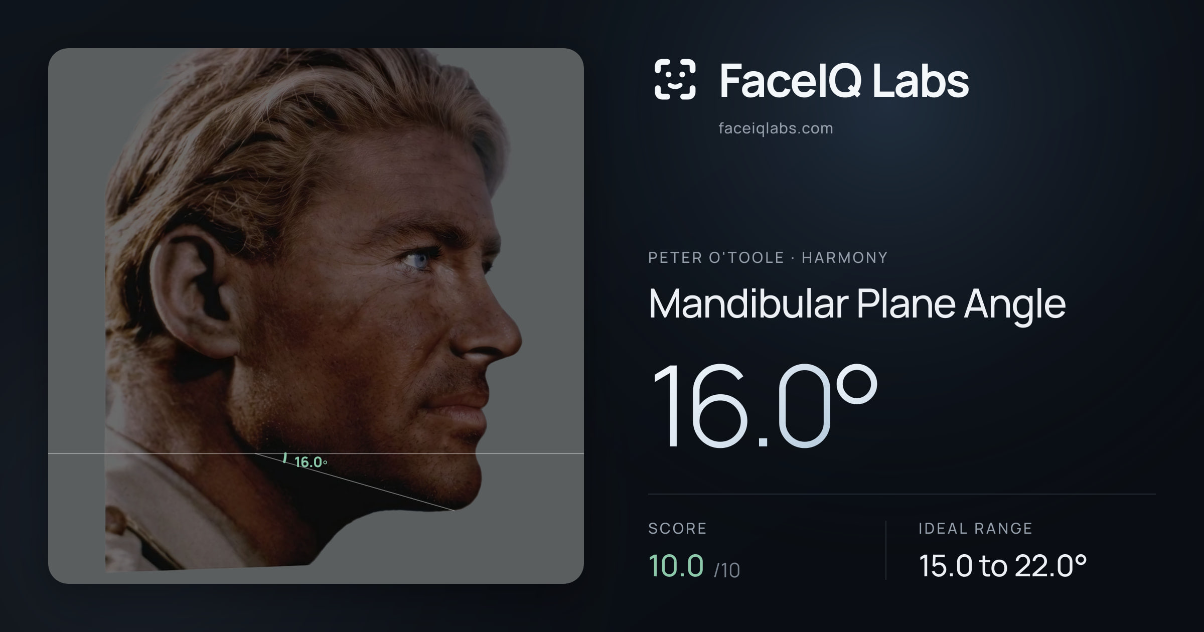 Peter O'Toole Mandibular Plane Angle: 16.0°, drawn on the photo