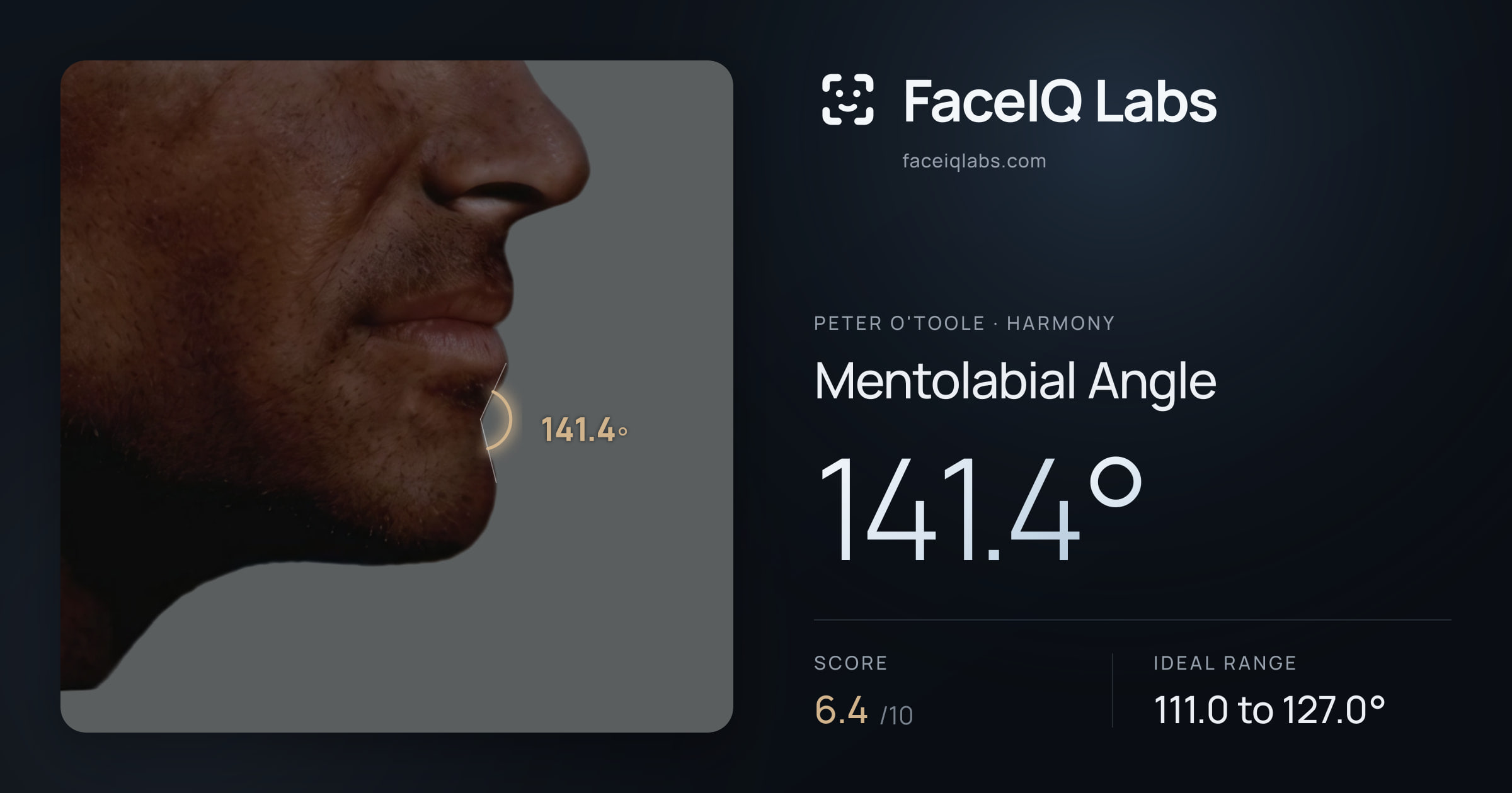 Peter O'Toole Mentolabial Angle: 141.4°, drawn on the photo