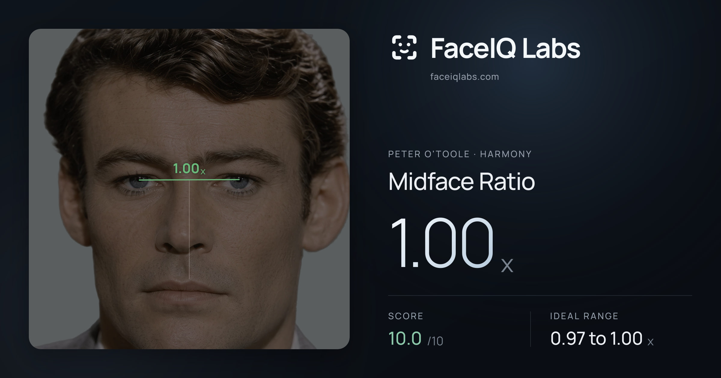 Peter O'Toole Midface Ratio: 1.00x, drawn on the photo