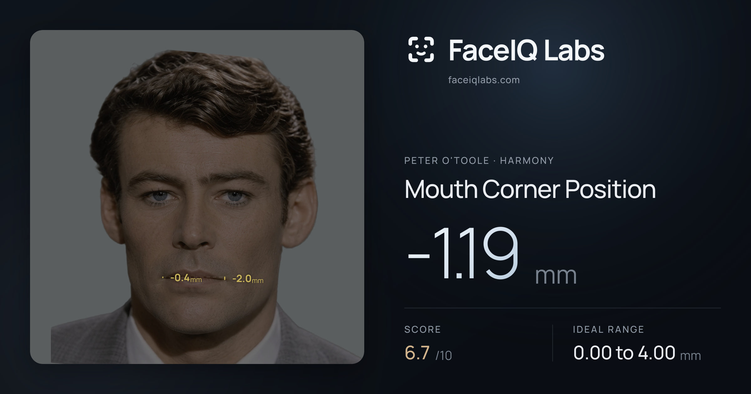 Peter O'Toole Mouth Corner Position: -1.19mm, drawn on the photo